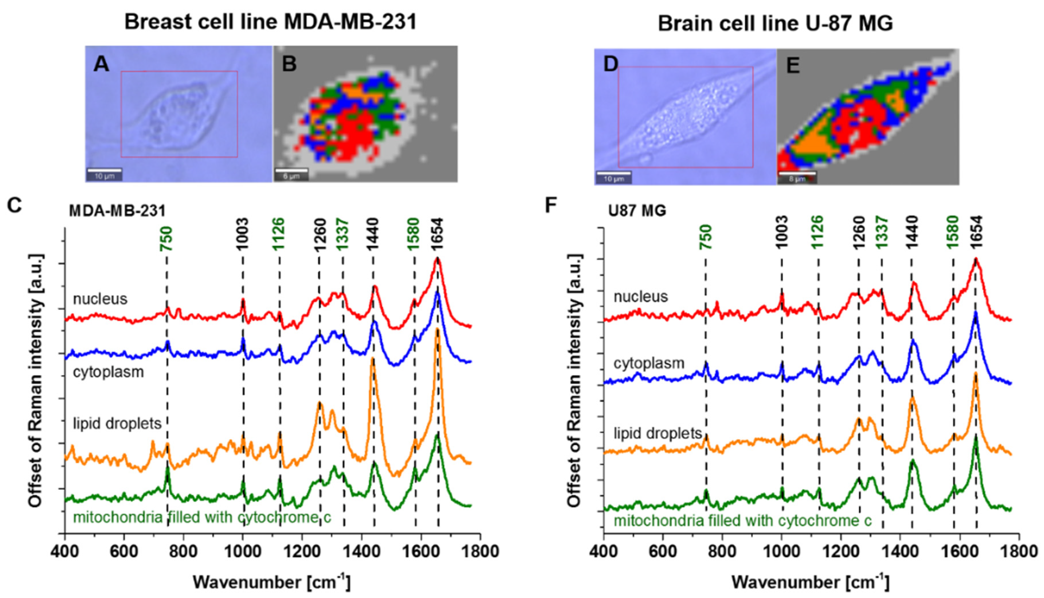 Cancers 13 02599 g004