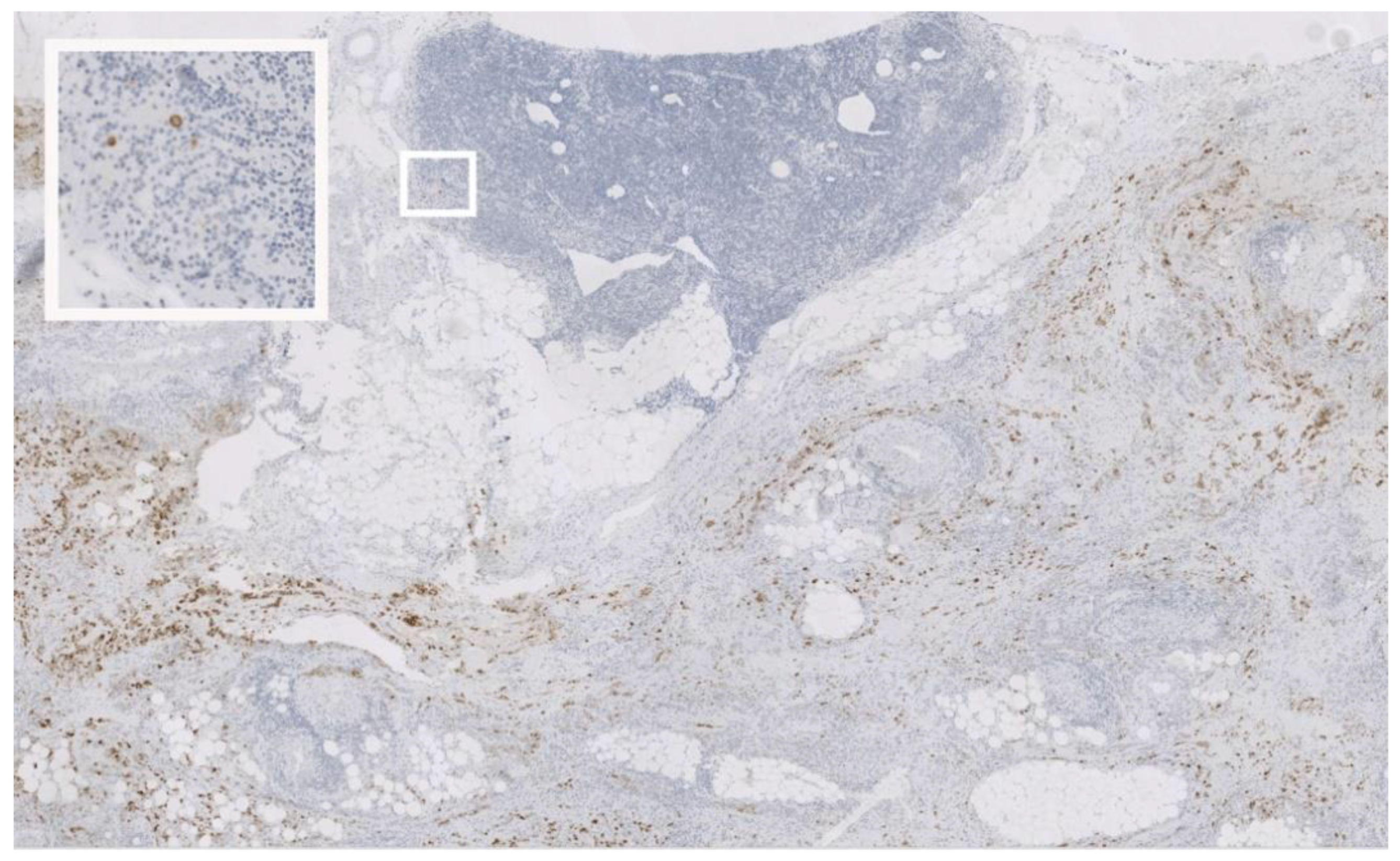 Cancers 13 02683 g002