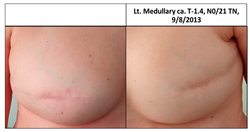 Cancers 13 02694 i008