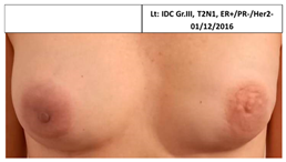 Cancers 13 02694 i010