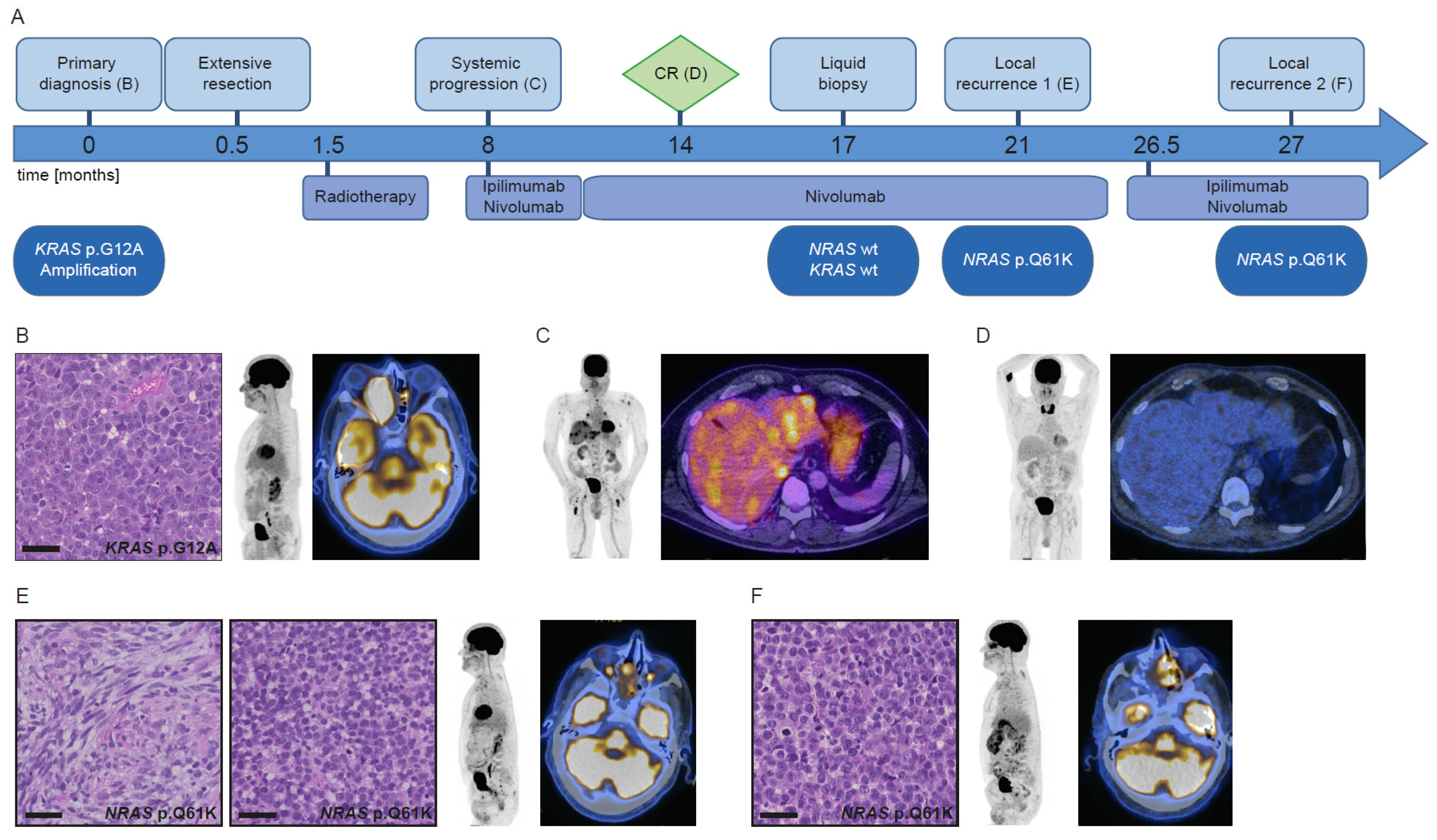 Cancers 13 02725 g002