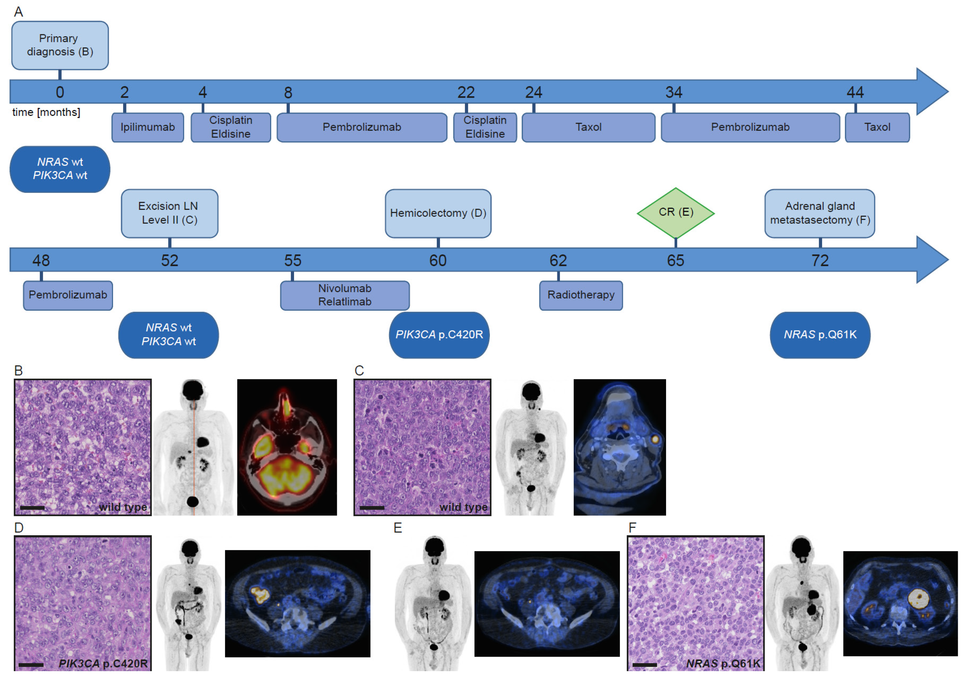 Cancers 13 02725 g003