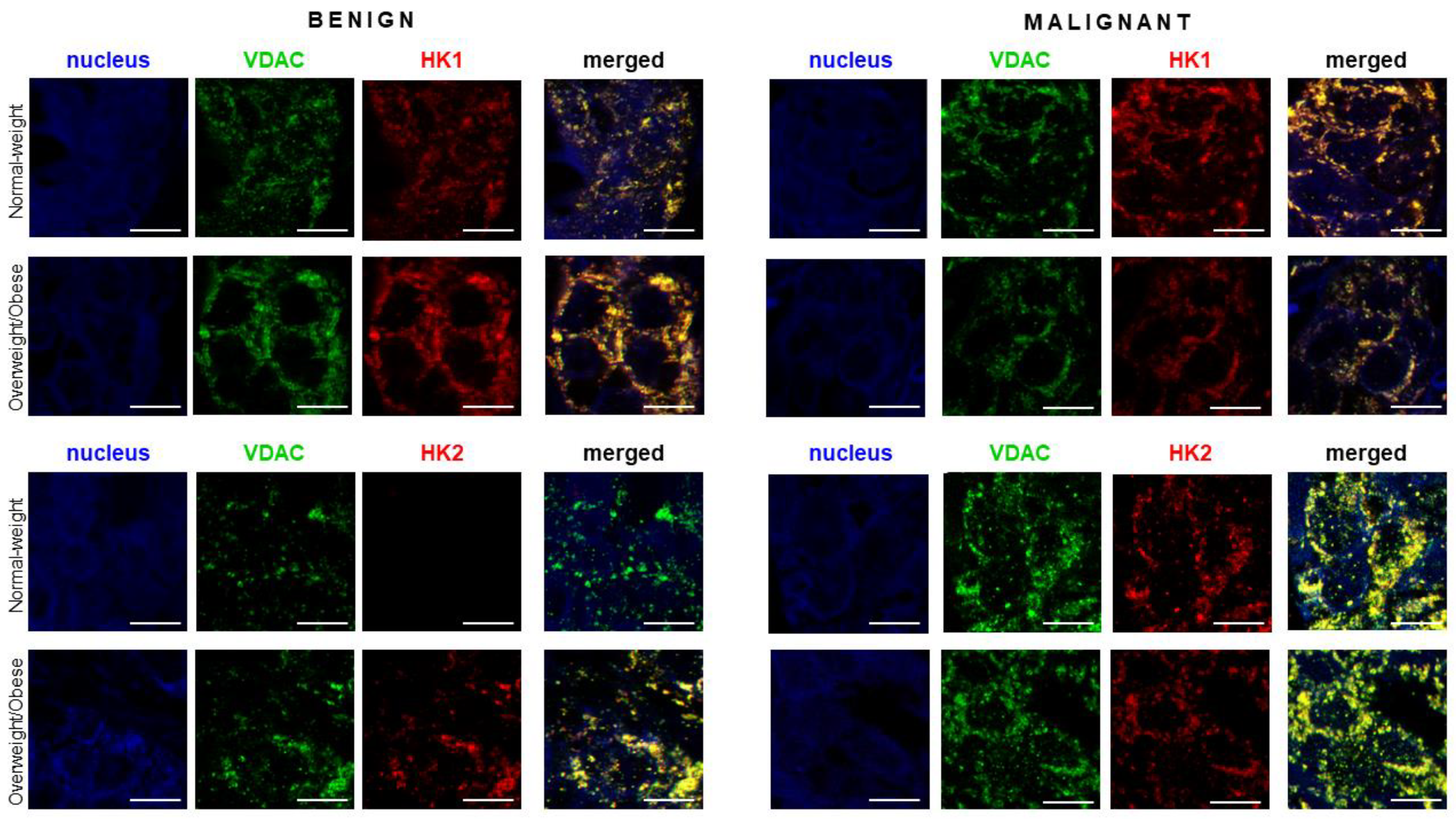 Cancers 13 02731 g005