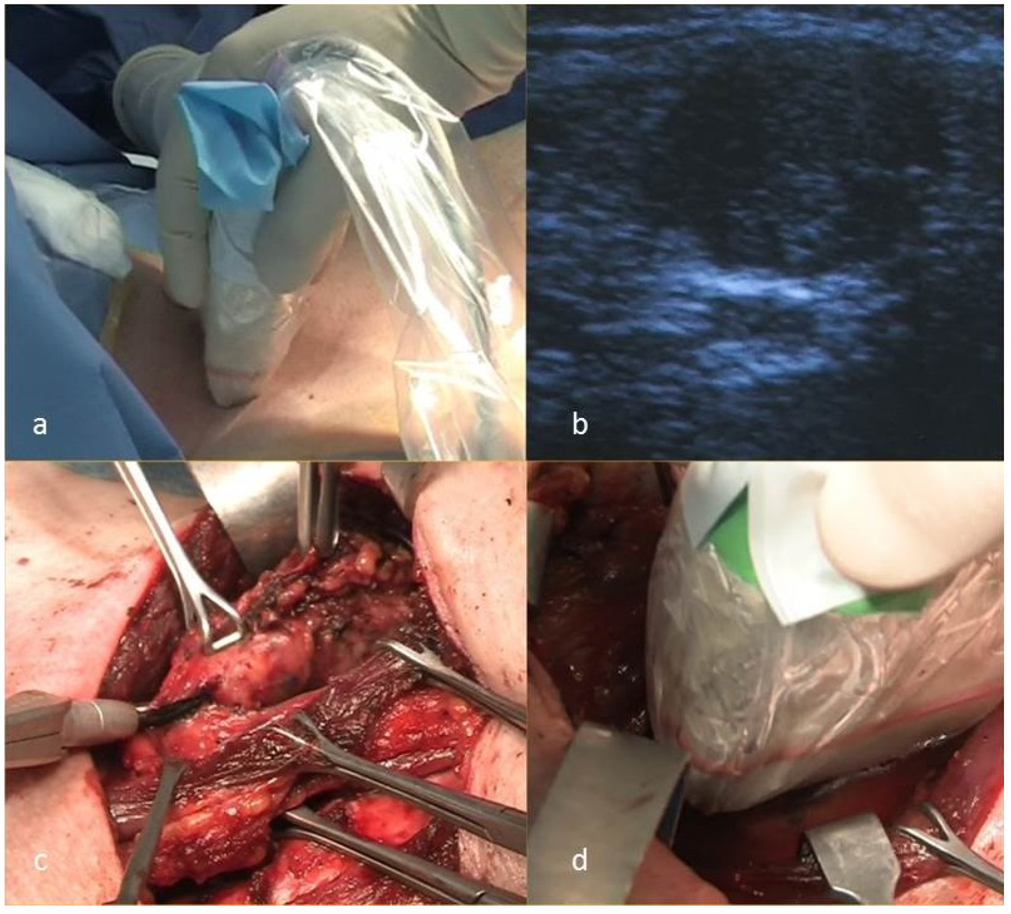 Cancers 13 02737 g001 Cancers 13 02737 g001