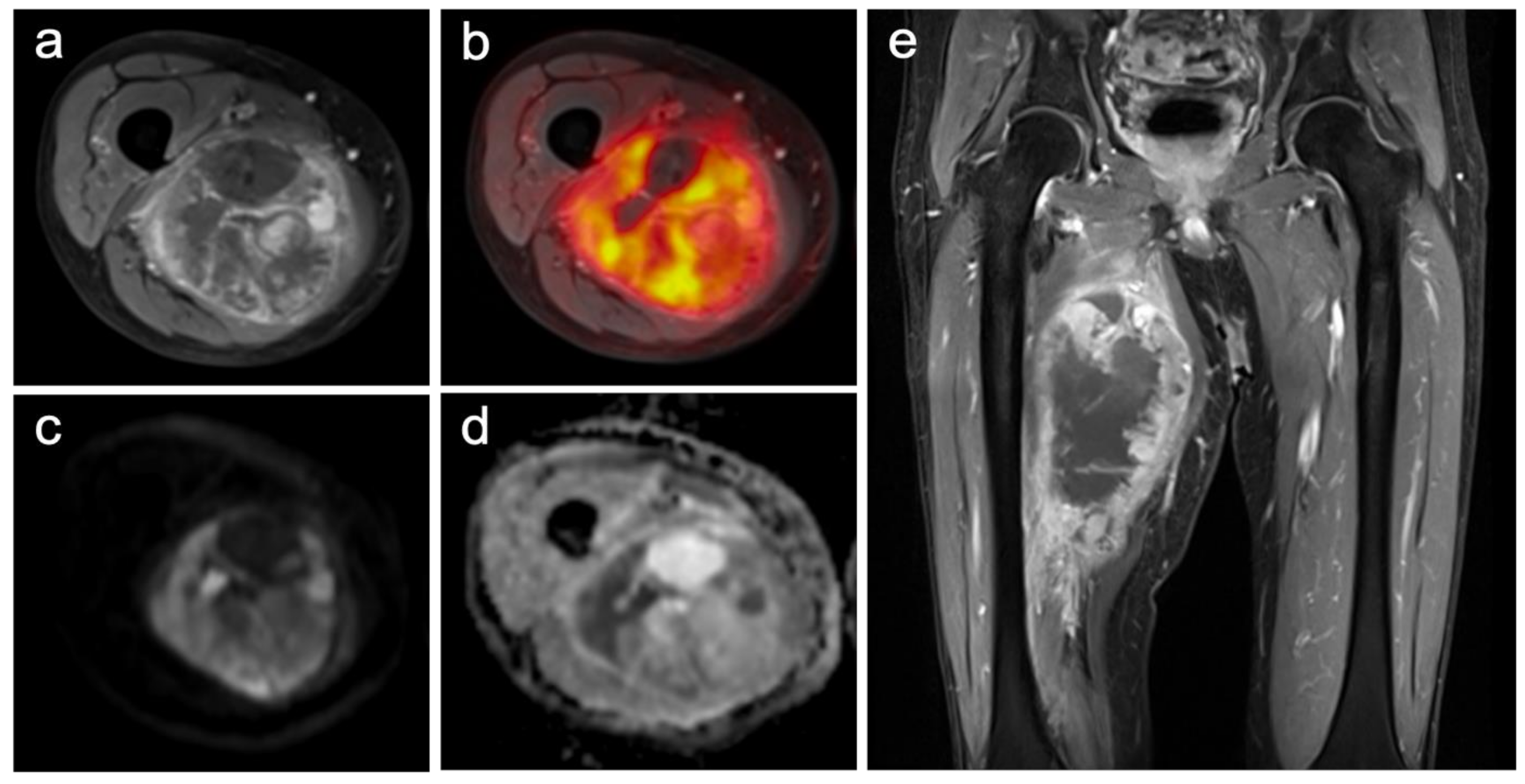 Cancers 13 02753 g001