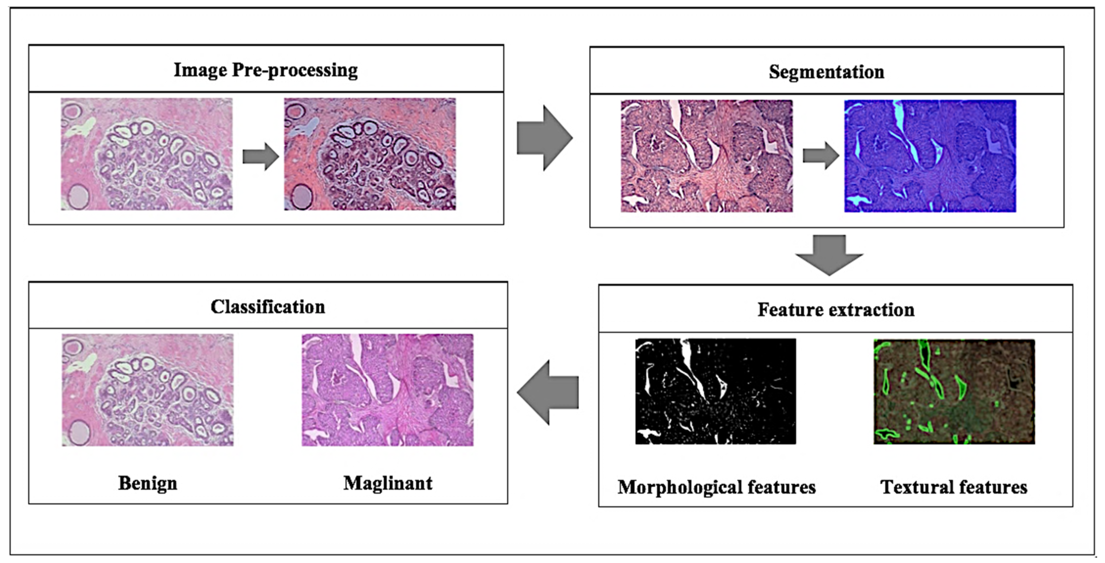 Cancers 13 02764 g002