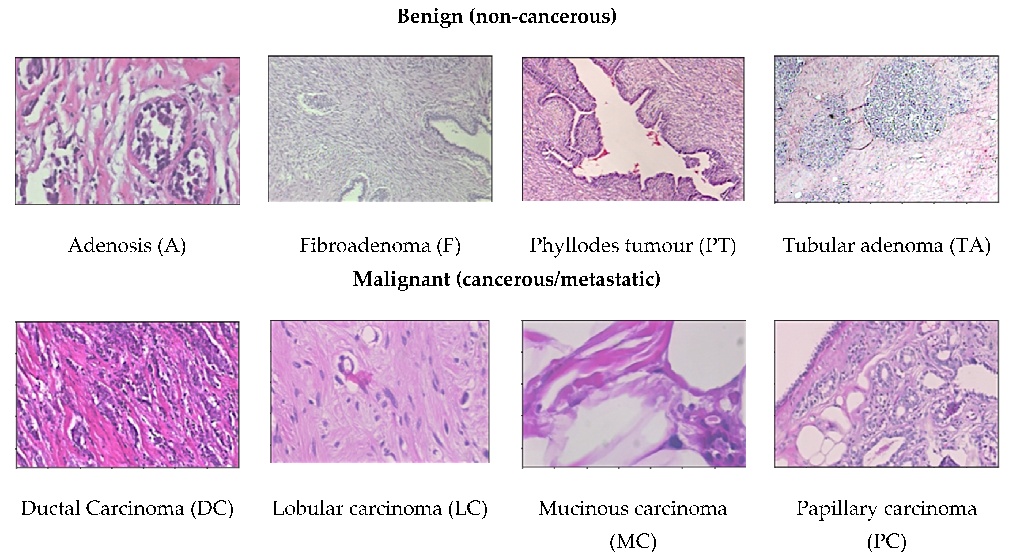 Cancers 13 02764 g005