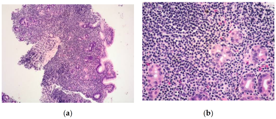 Cancers 13 02790 g001