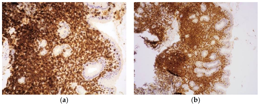 Cancers 13 02790 g003