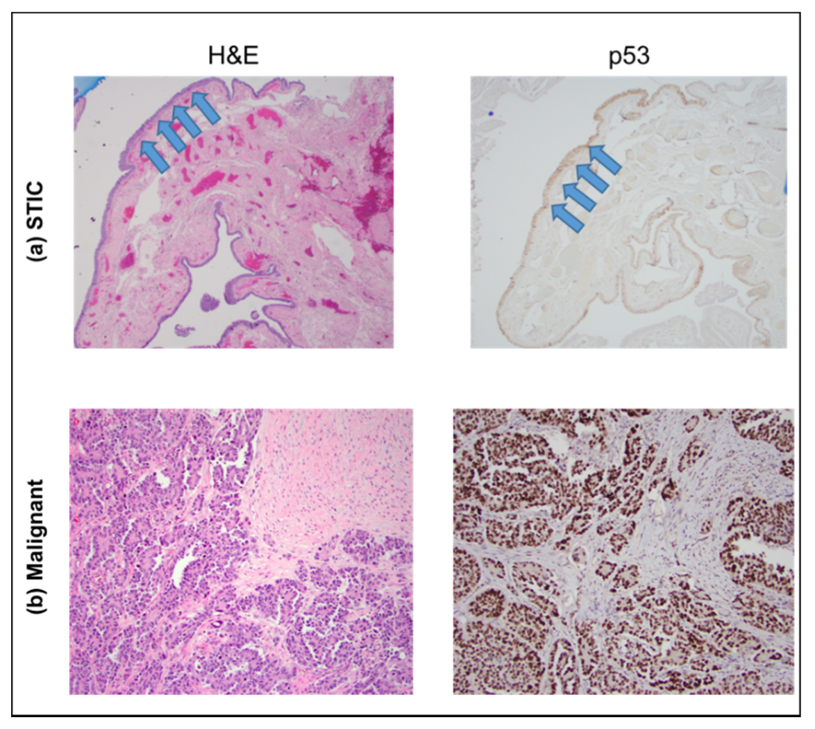 Cancers 13 02794 g002