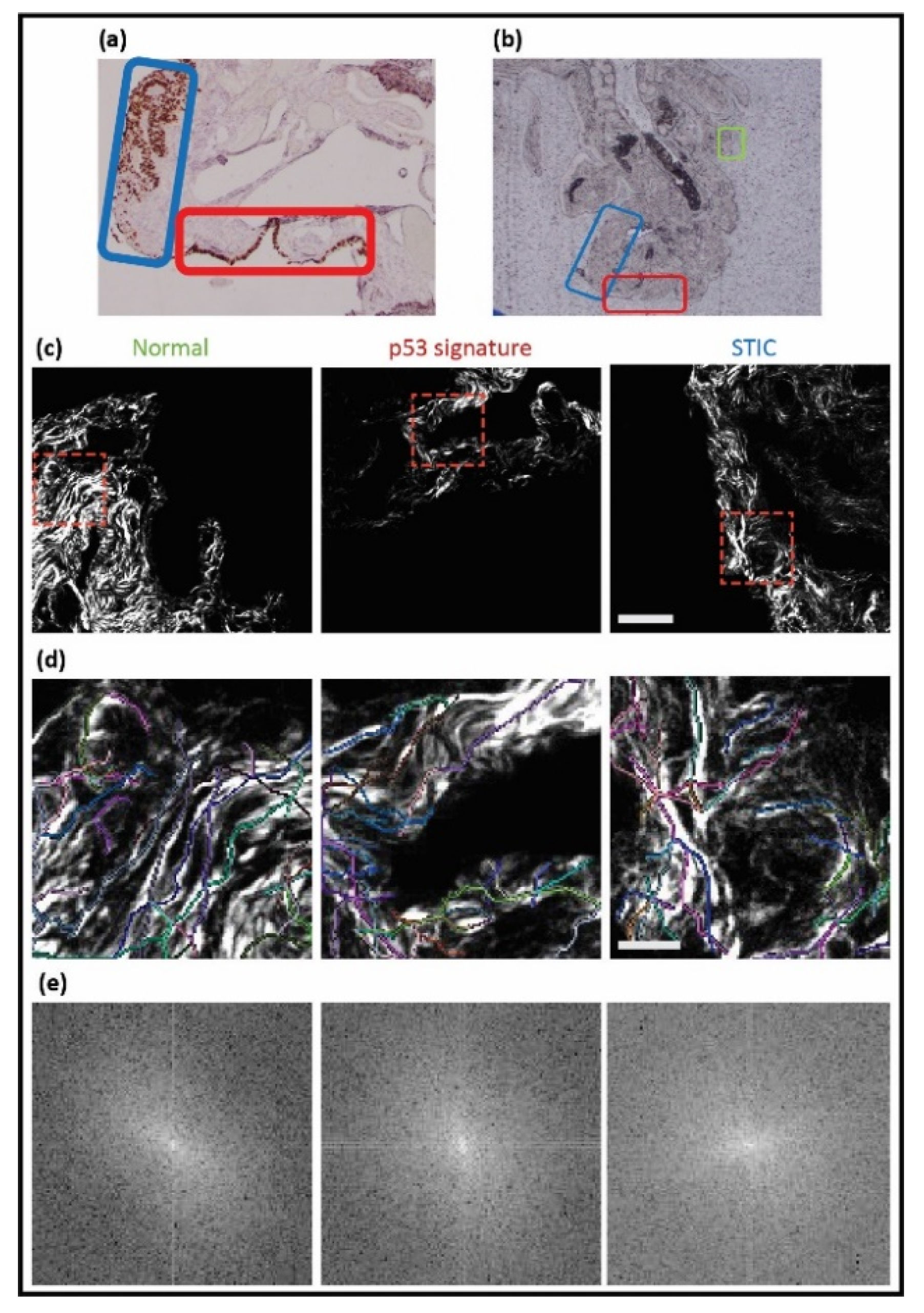 Cancers 13 02794 g003