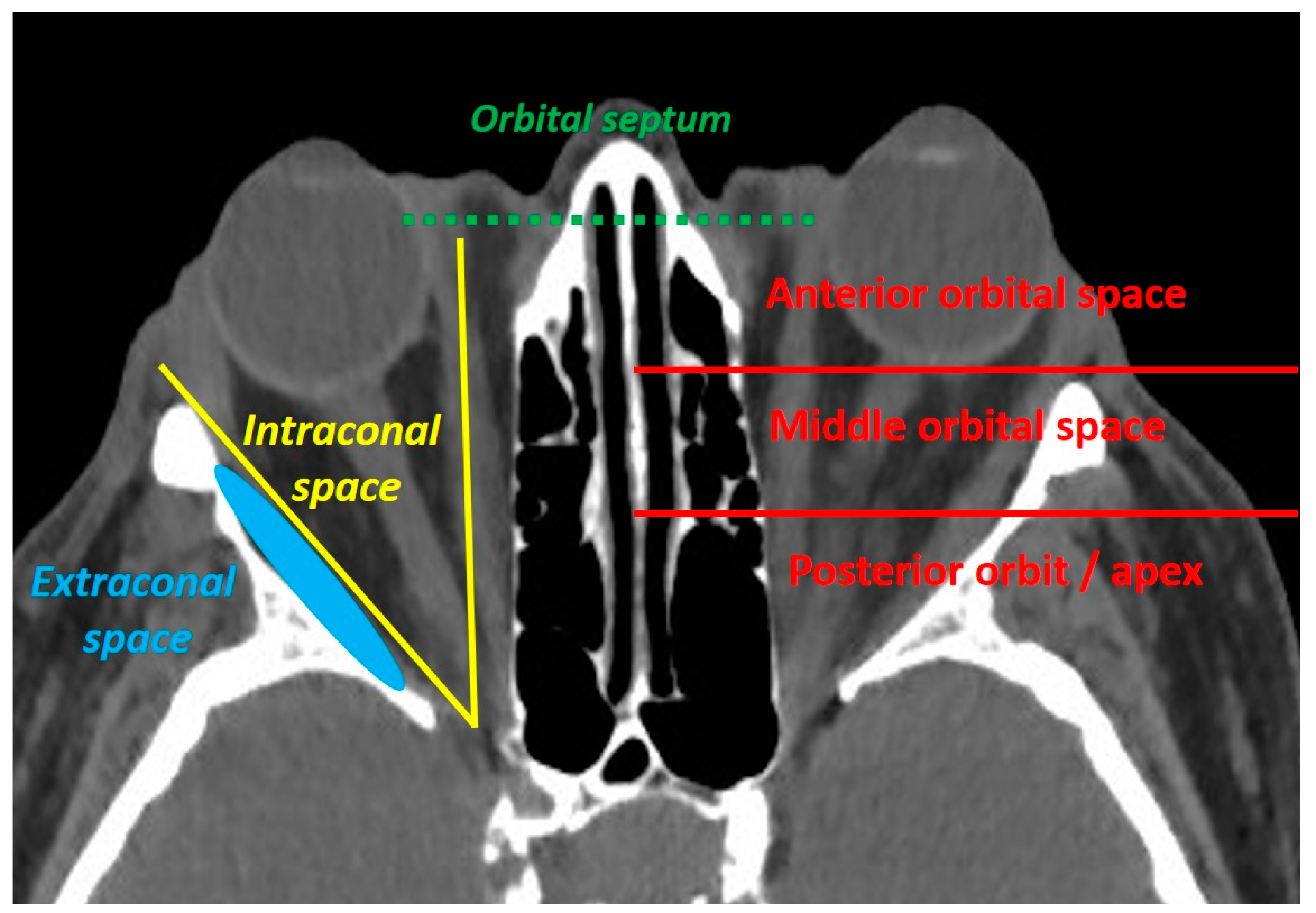 Cancers 13 02822 g001