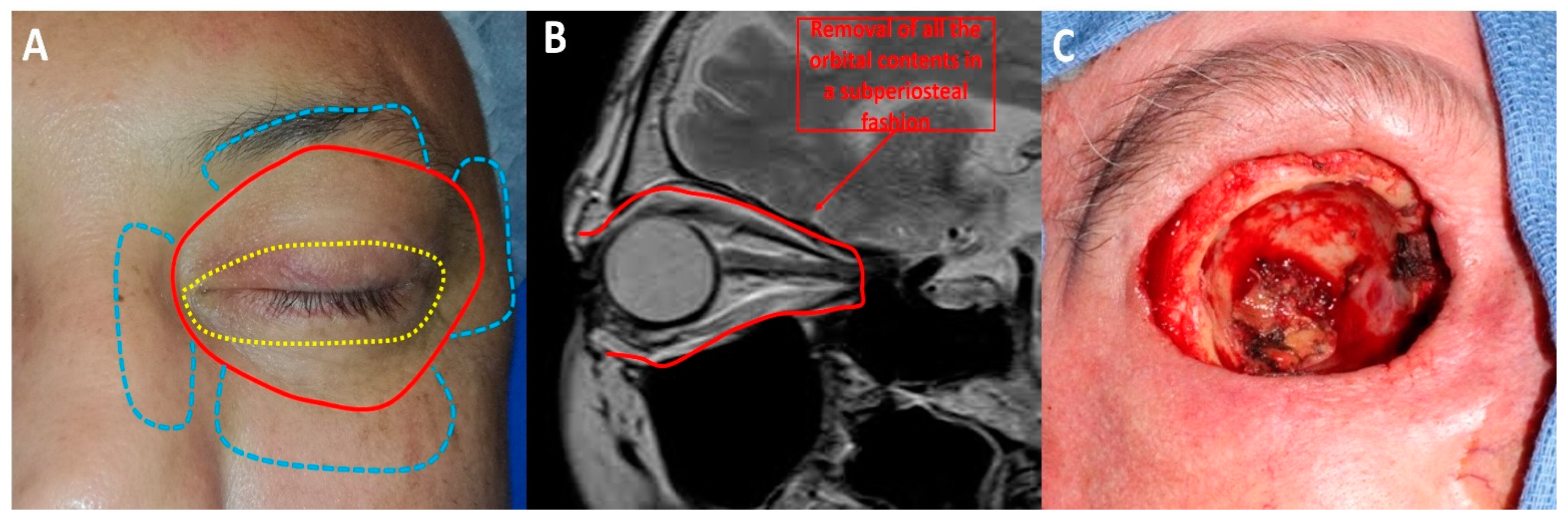 Cancers 13 02822 g002