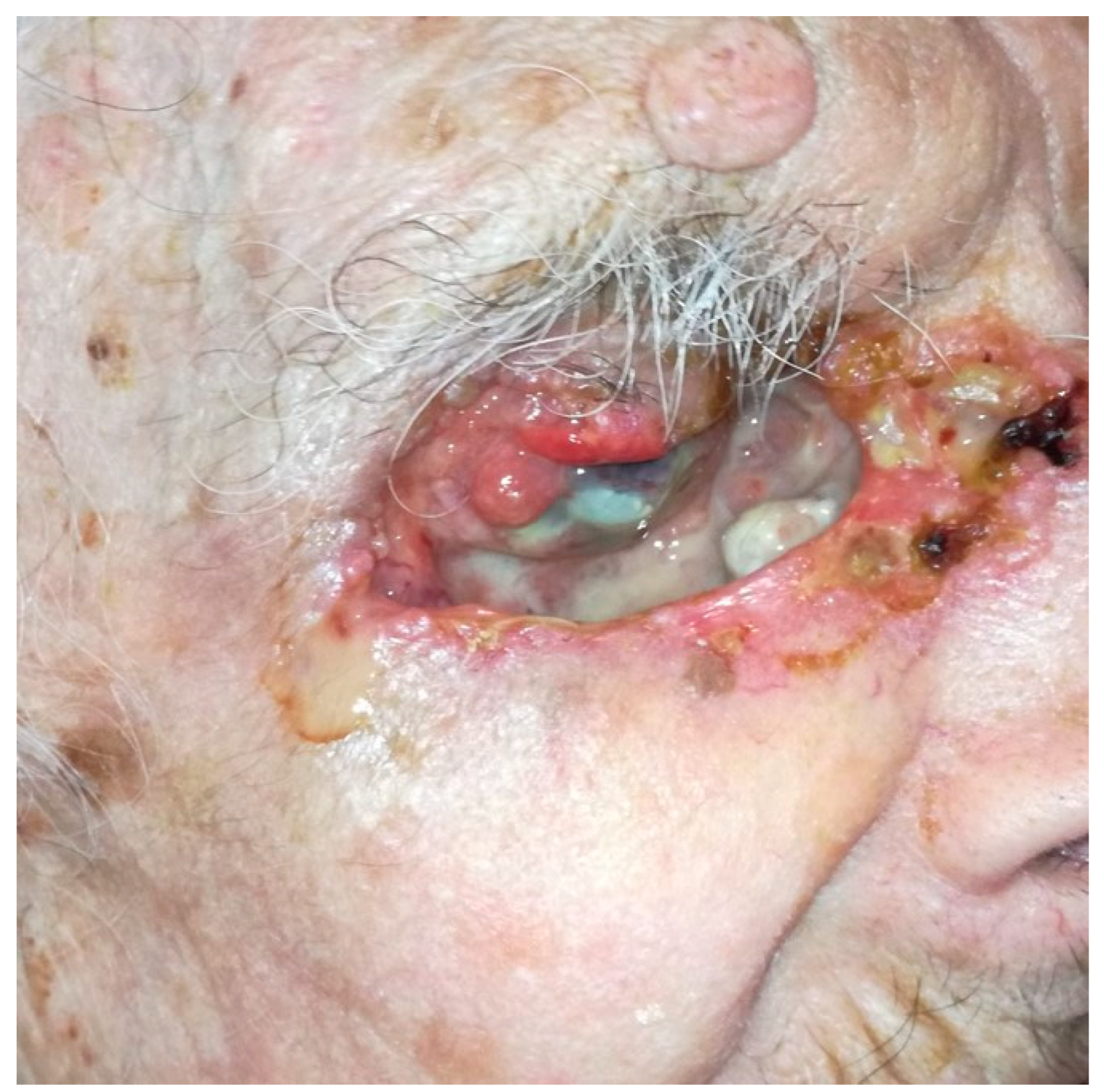 Cancers 13 02822 g003