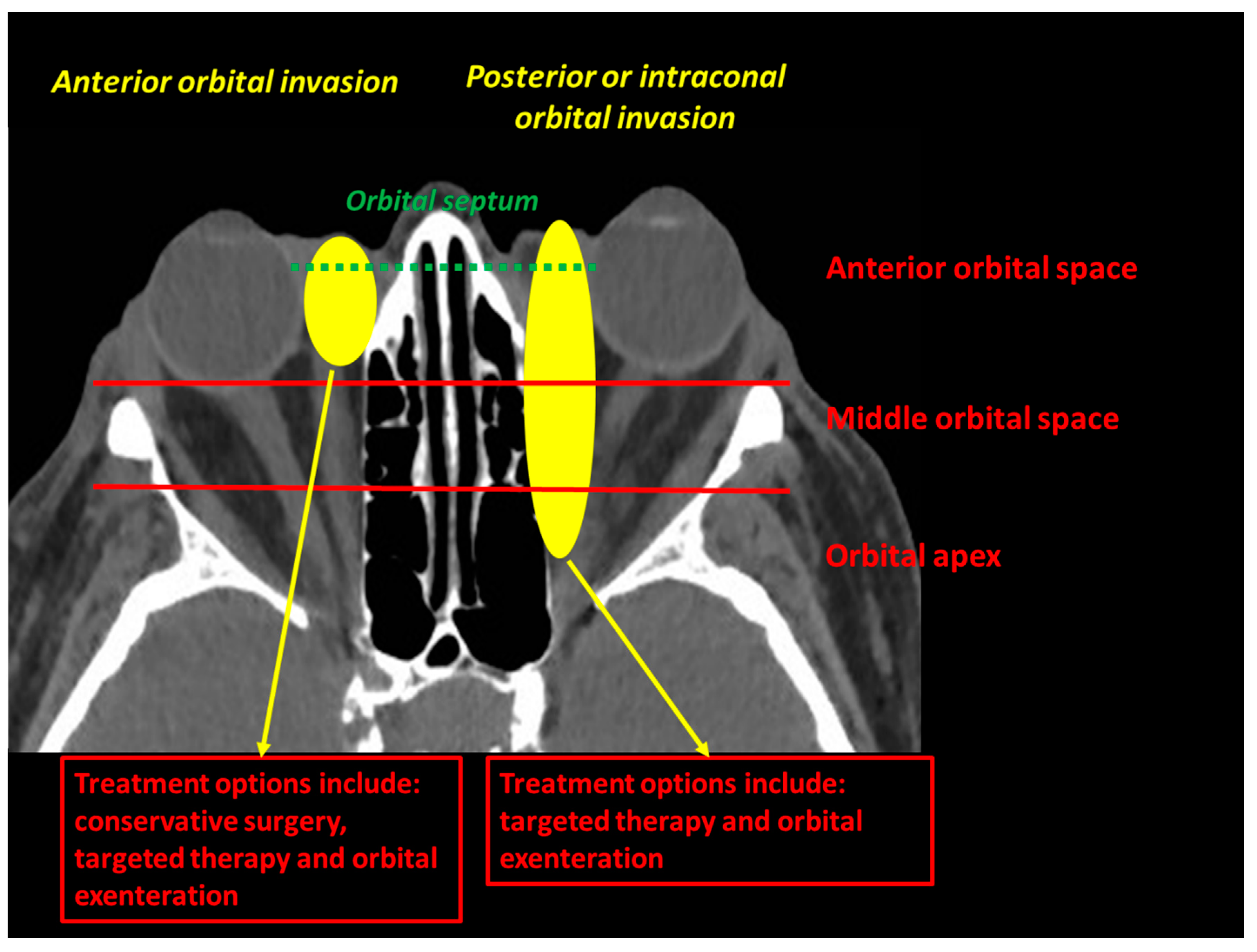 Cancers 13 02822 g007
