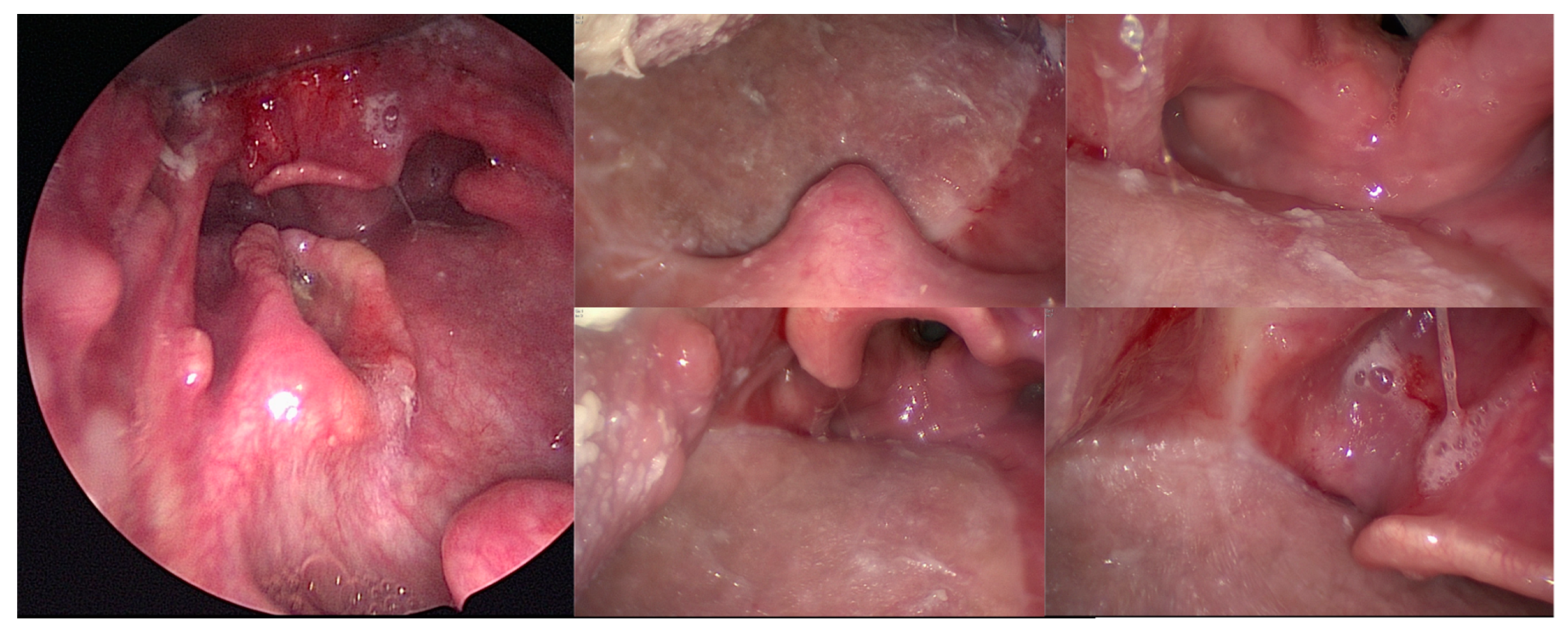 Cancers 13 02831 g002