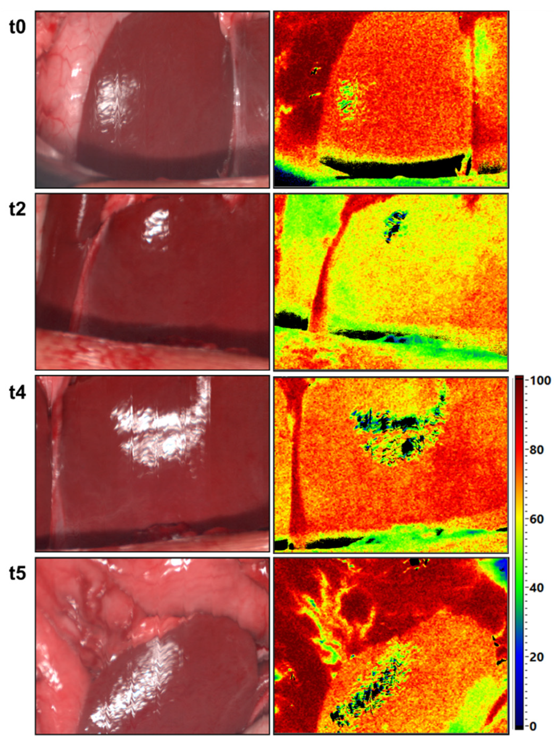 Cancers 13 02846 g008