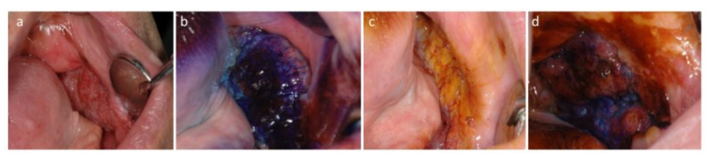 Cancers 13 02864 g001 Cancers 13 02864 g001