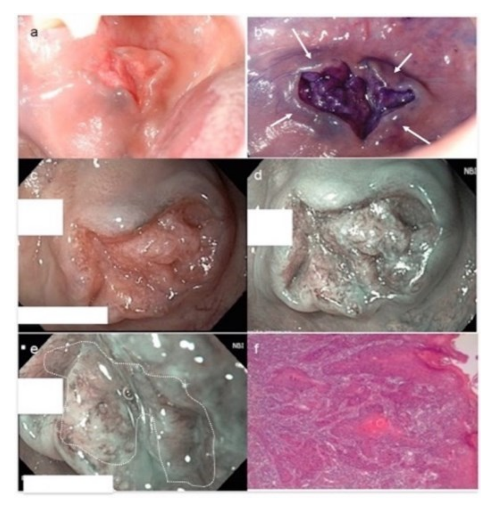 Cancers 13 02864 g004 Cancers 13 02864 g004