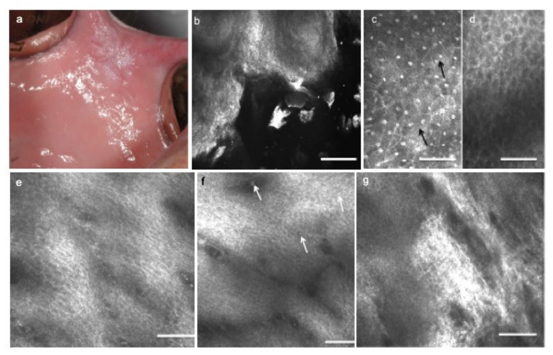 Cancers 13 02864 g006 Cancers 13 02864 g006