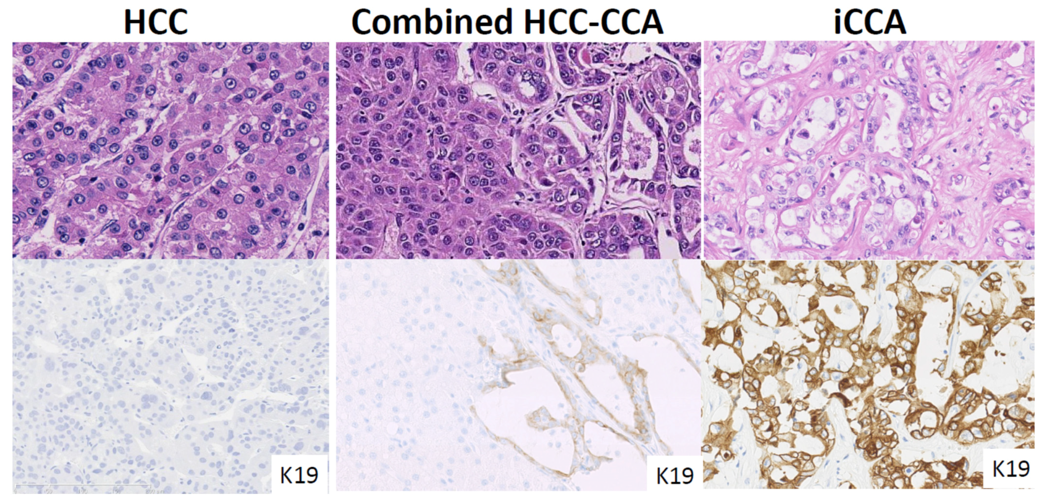 Cancers 13 02871 g001