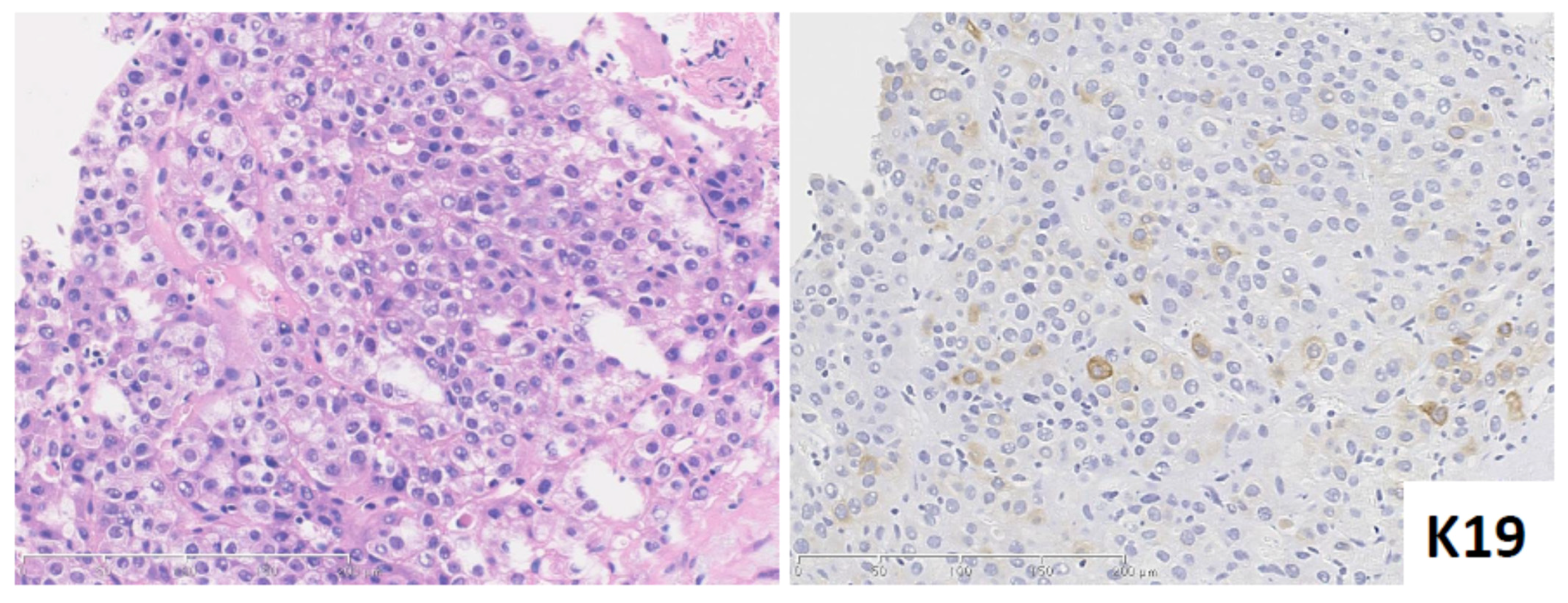 Cancers 13 02871 g002