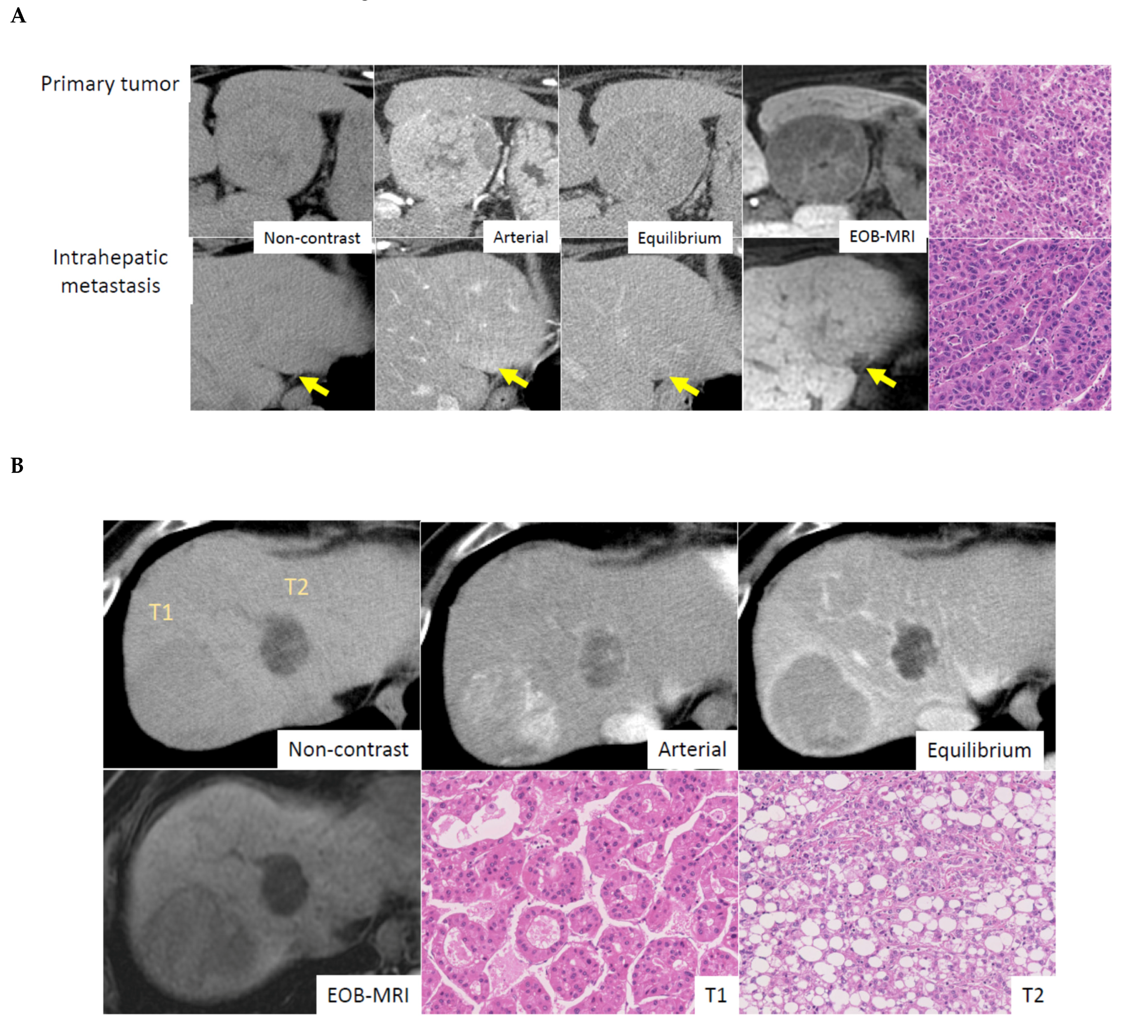 Cancers 13 02871 g003