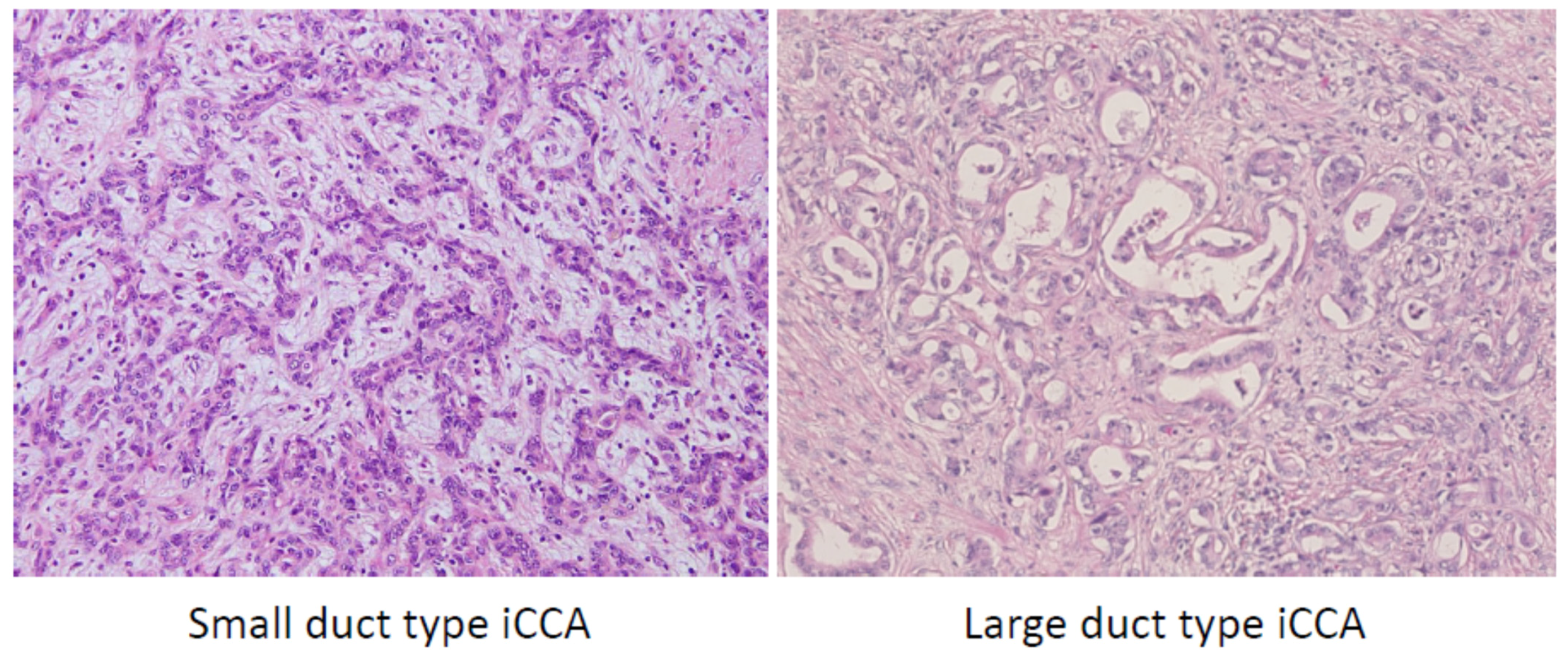 Cancers 13 02871 g004