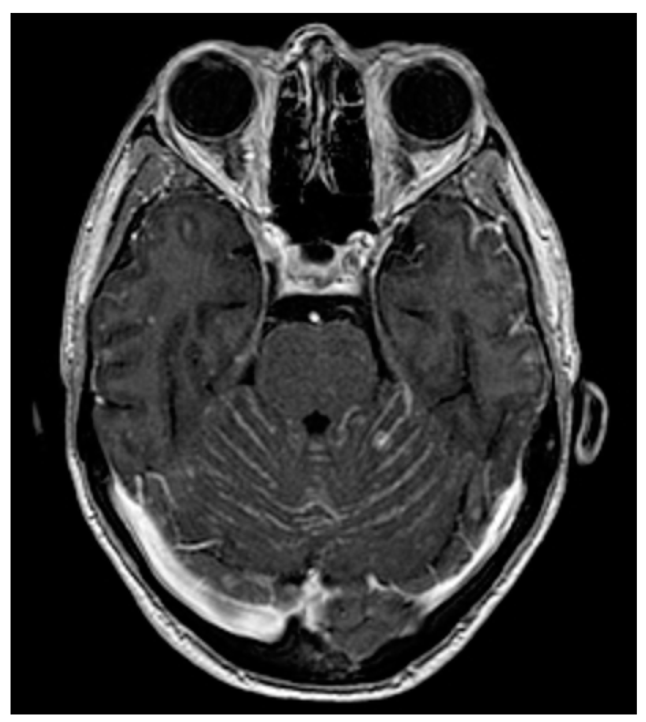 Cancers 13 02888 g001