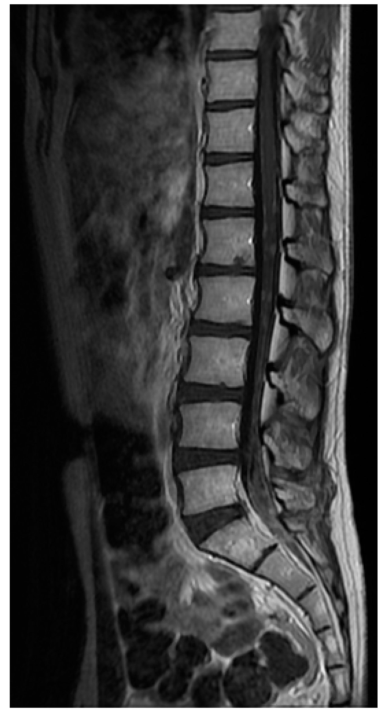 Cancers 13 02888 g003