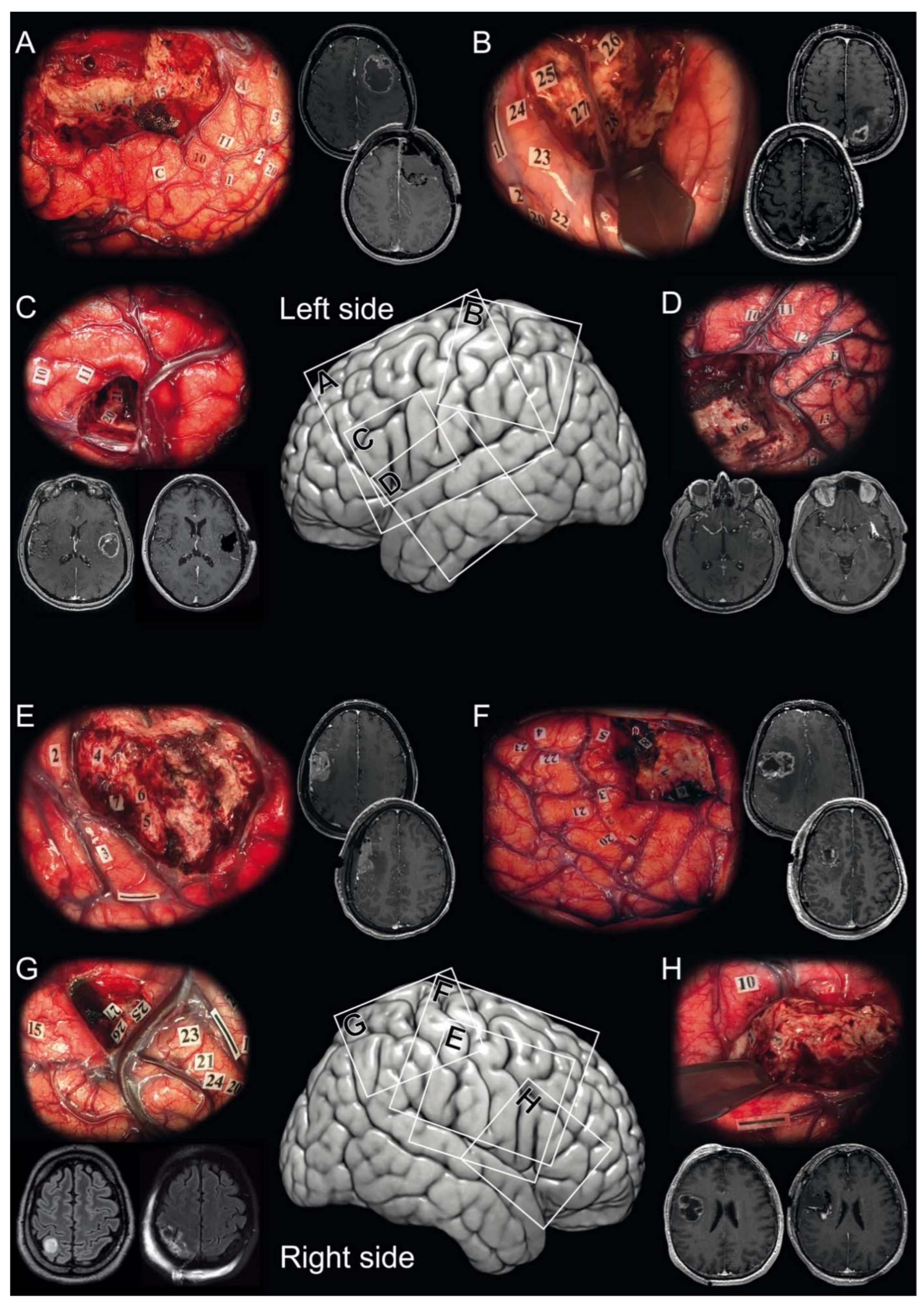 Cancers 13 02911 g001 Cancers 13 02911 g001