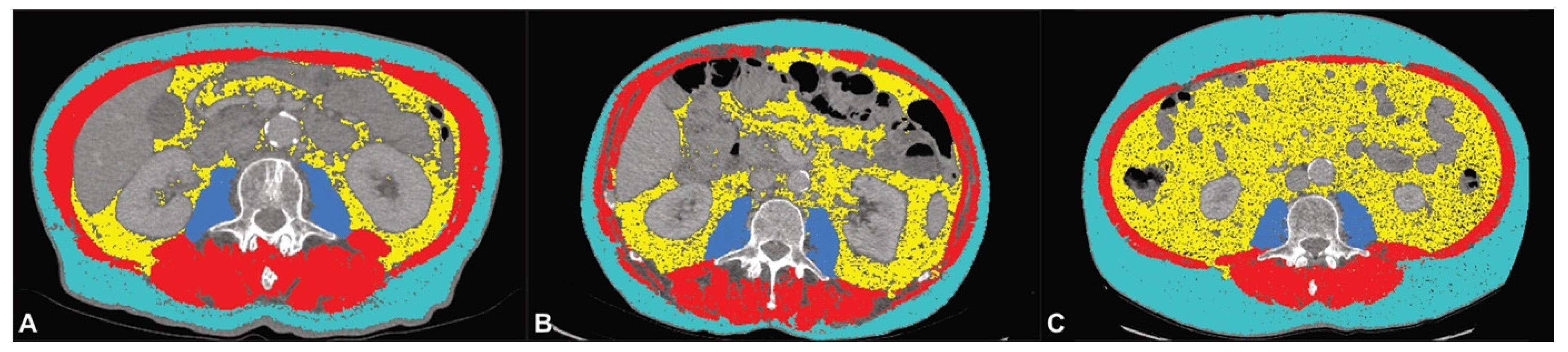 Cancers 13 02921 g003
