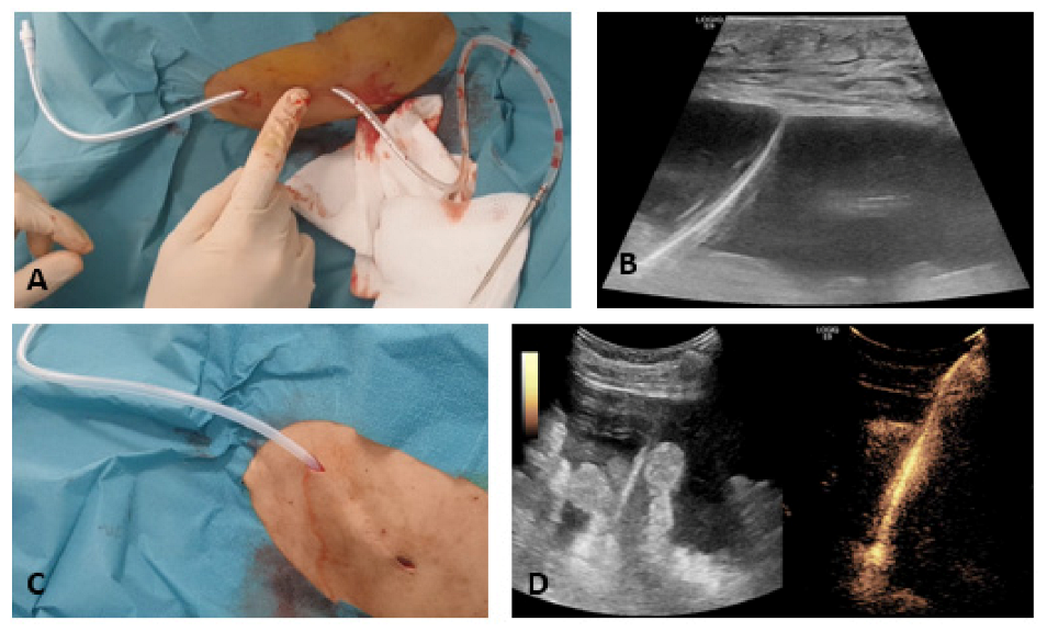 Cancers 13 02926 g001