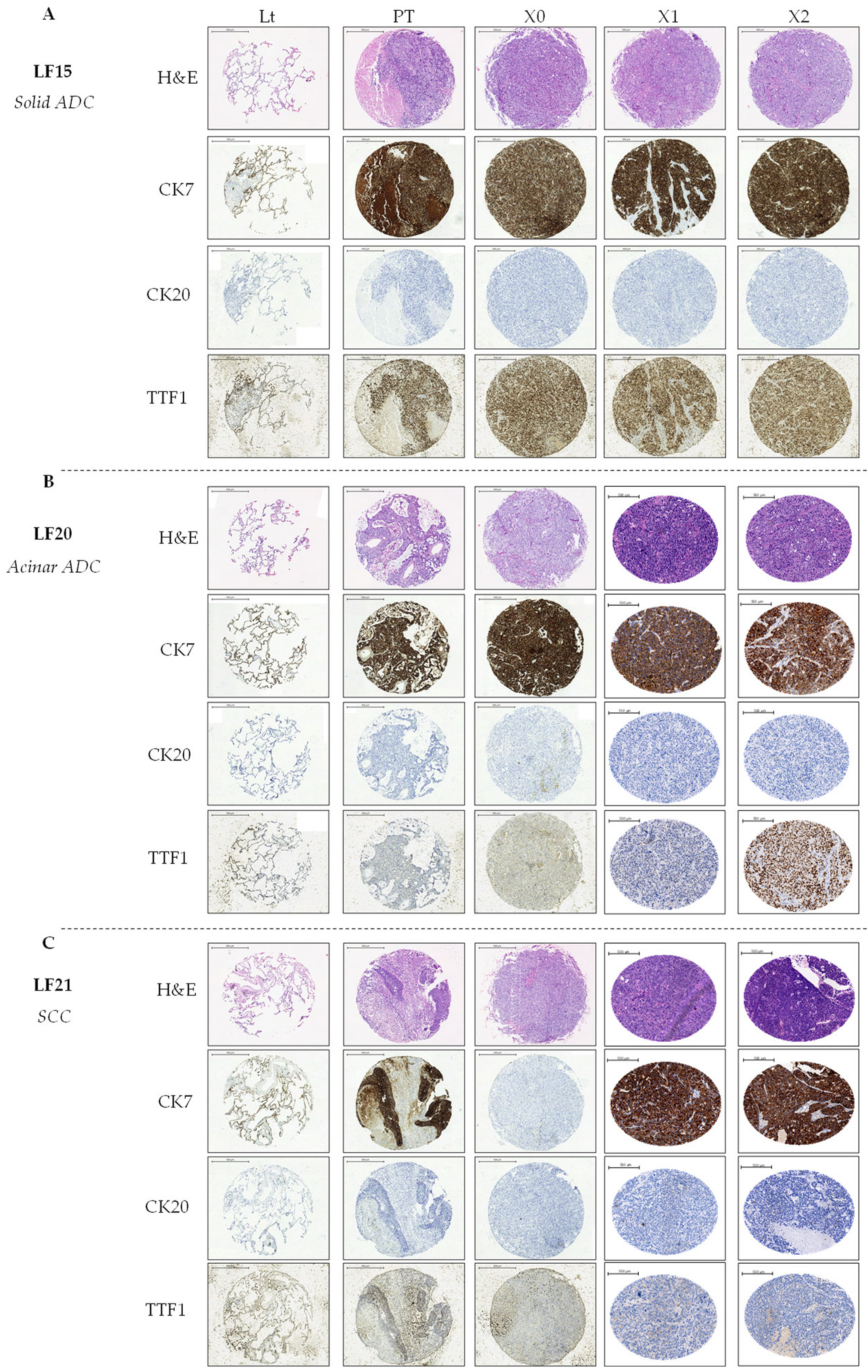 Cancers 13 02980 g004