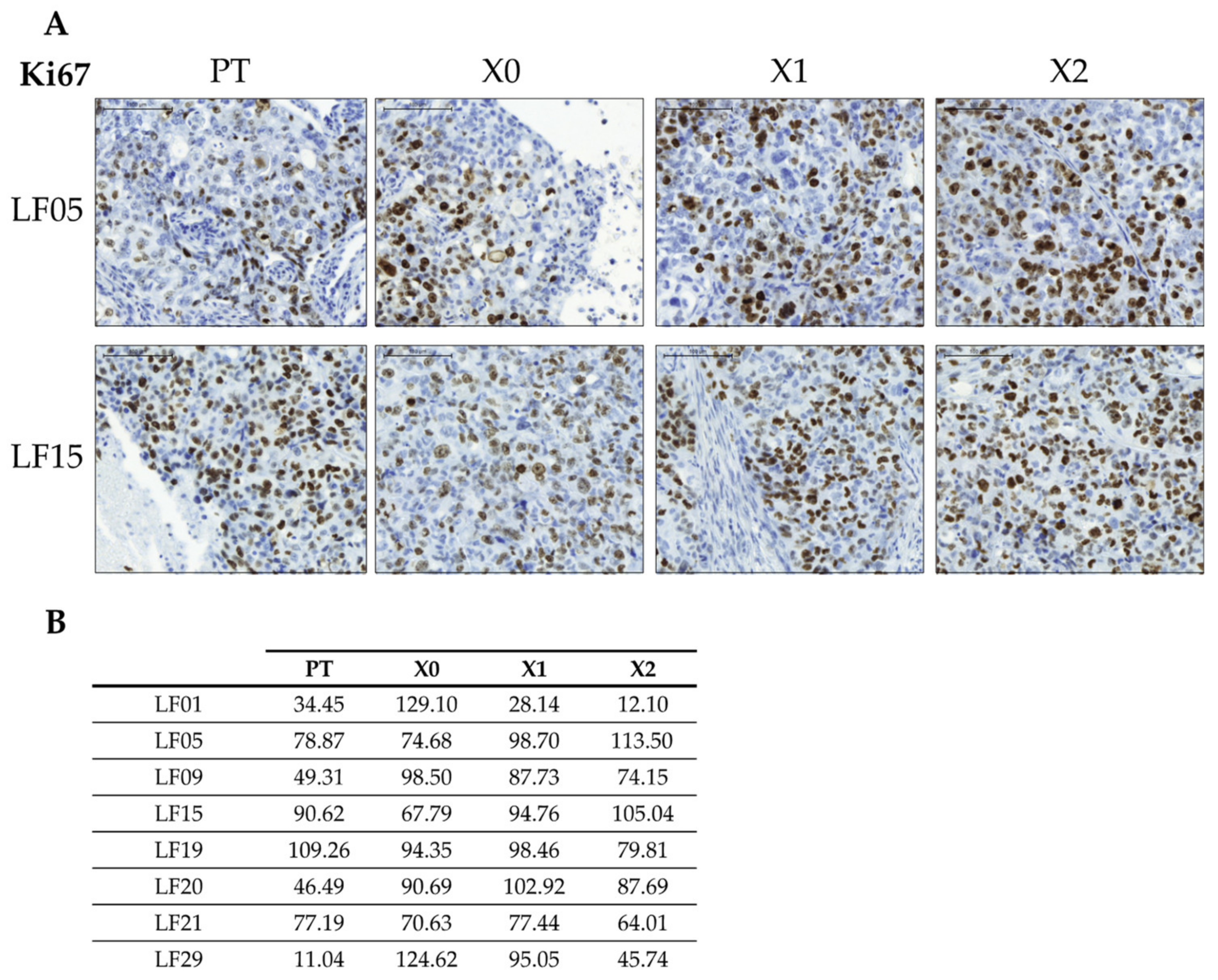 Cancers 13 02980 g007