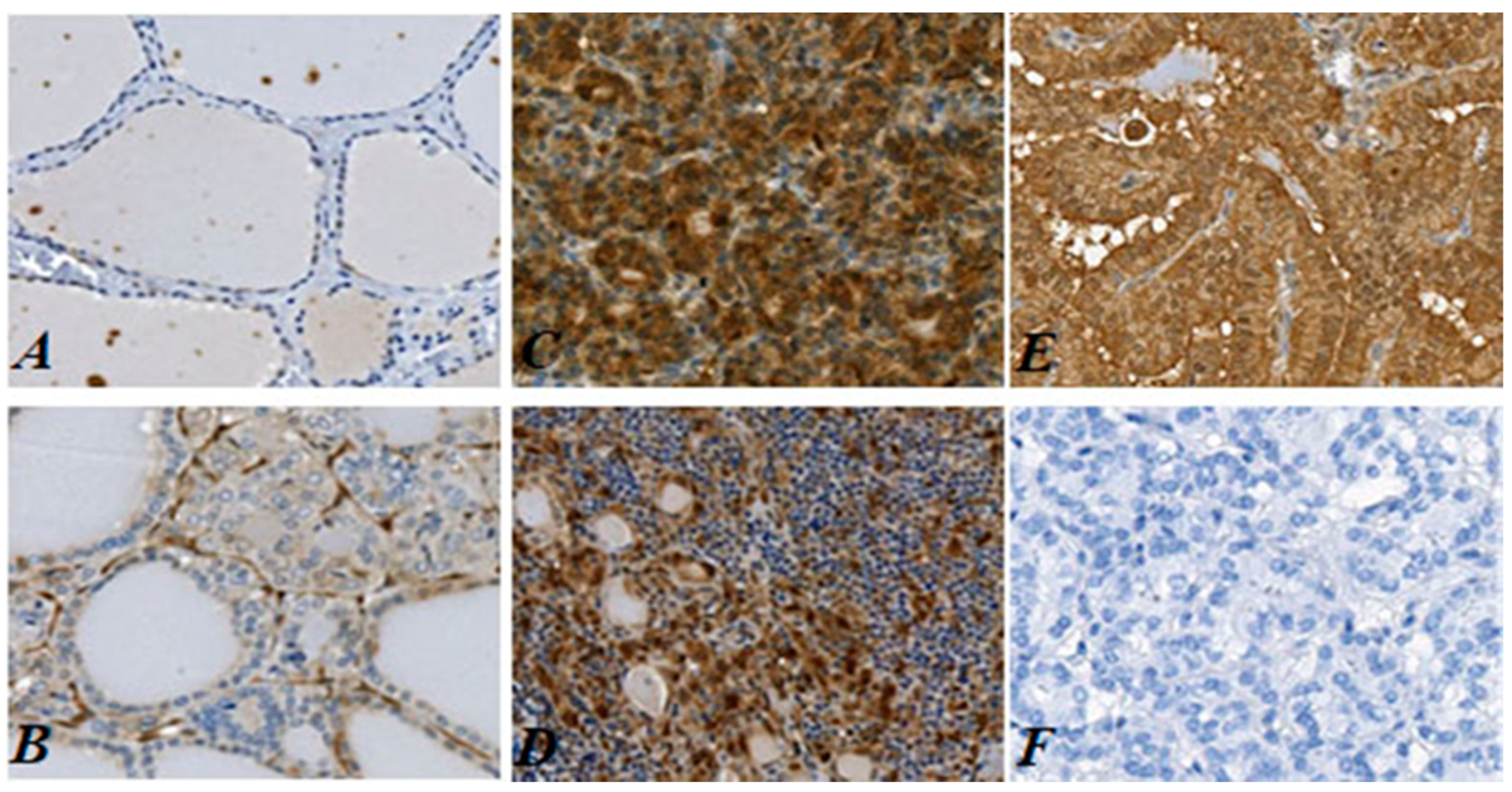 Cancers 13 02988 g001