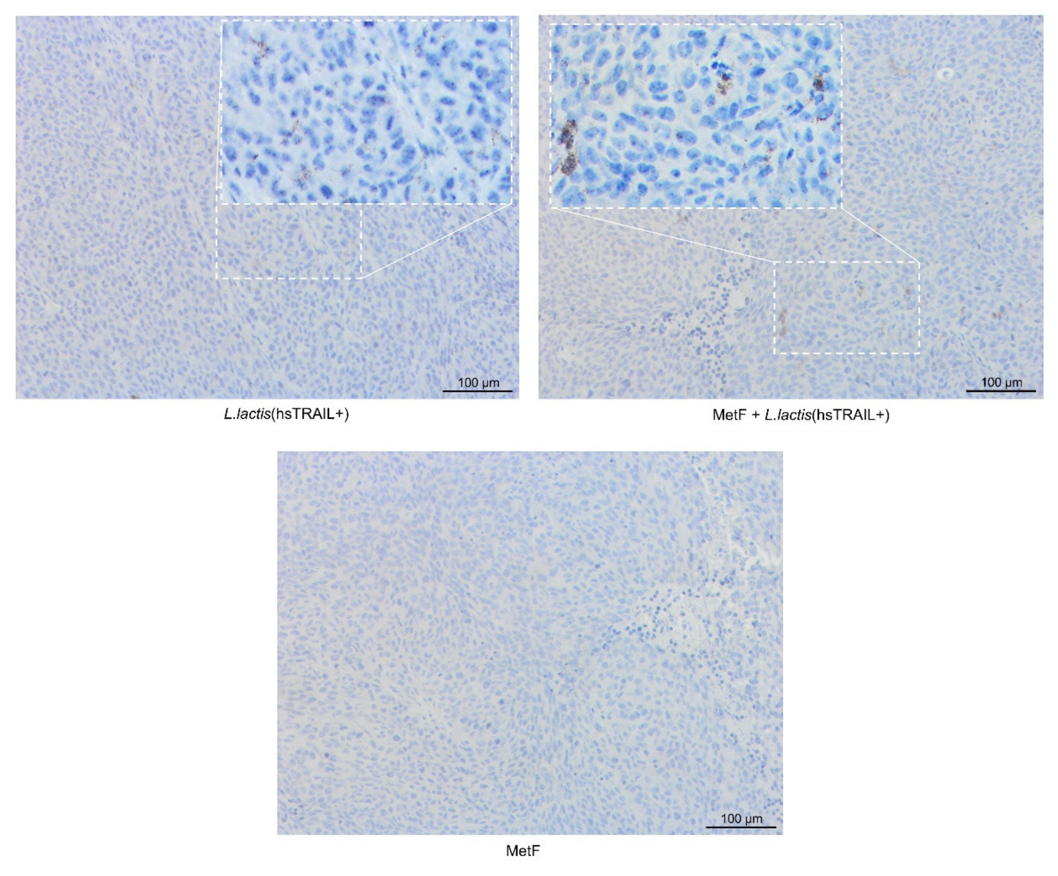 Cancers 13 03004 g006b