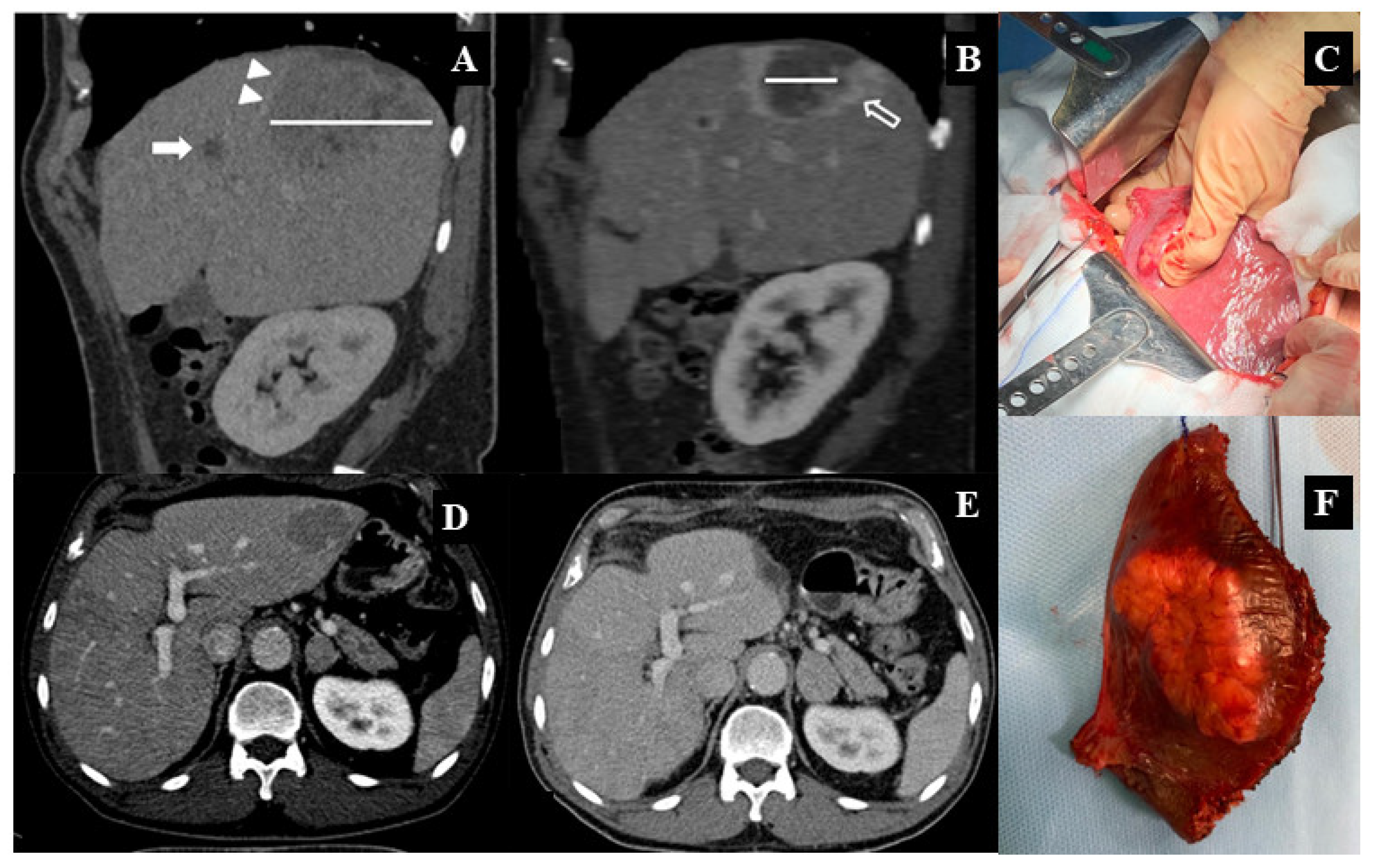 Cancers 13 03025 g002