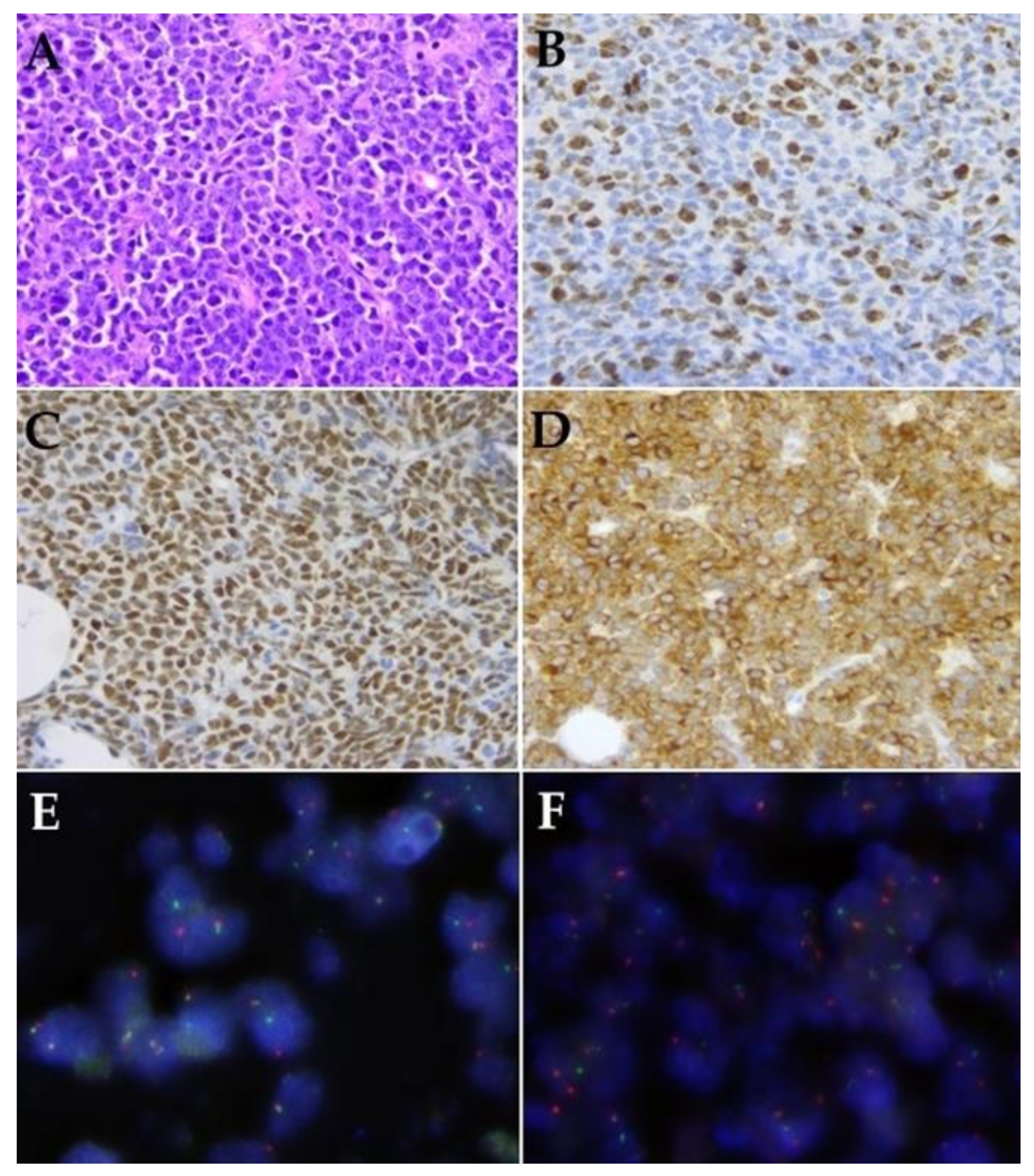 Cancers 13 03032 g002