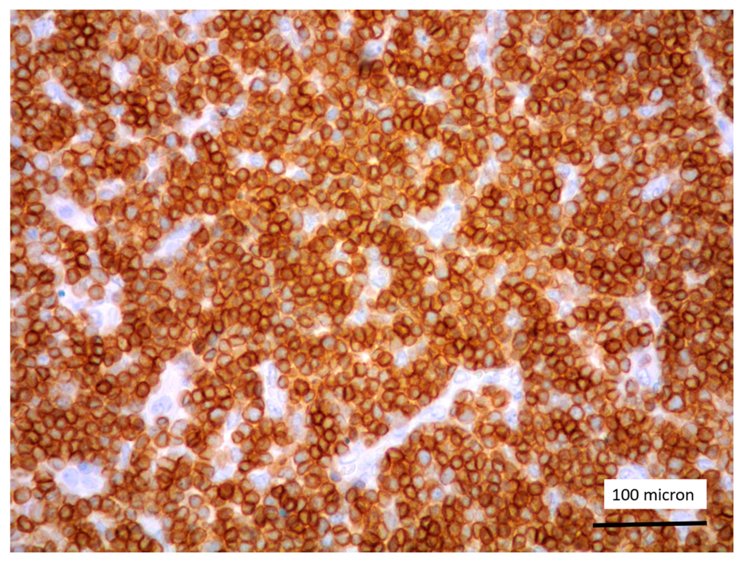 Cancers 13 03102 g003