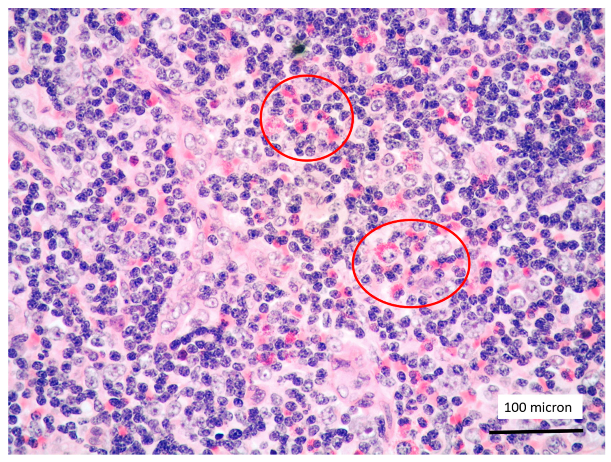 Cancers 13 03102 g005