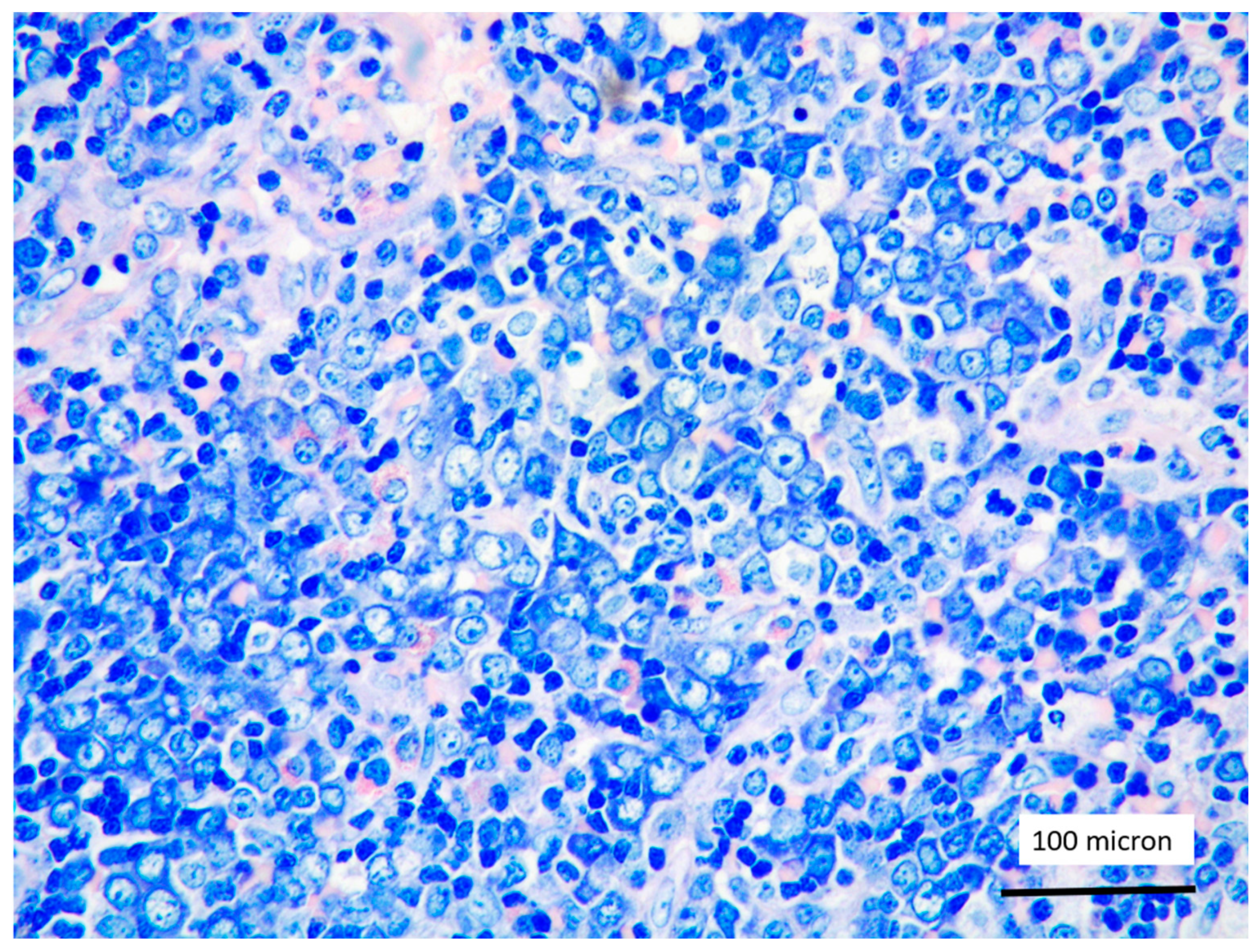 Cancers 13 03102 g006