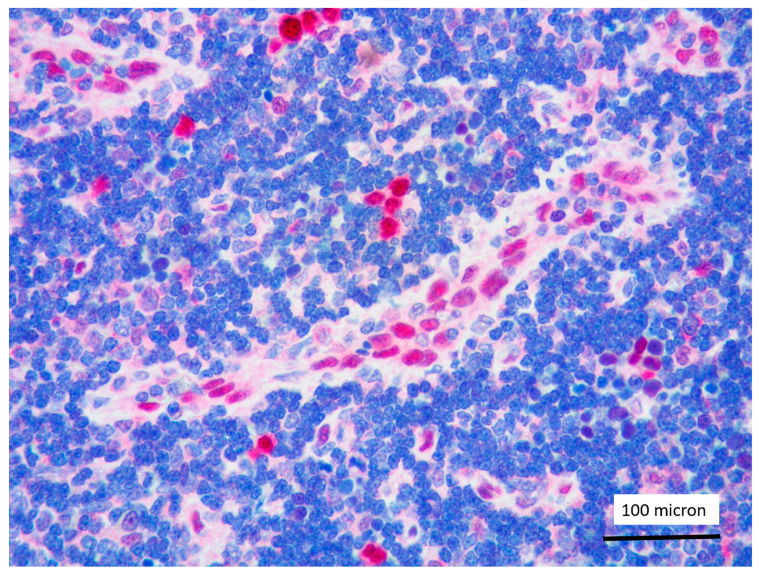 Cancers 13 03102 g008