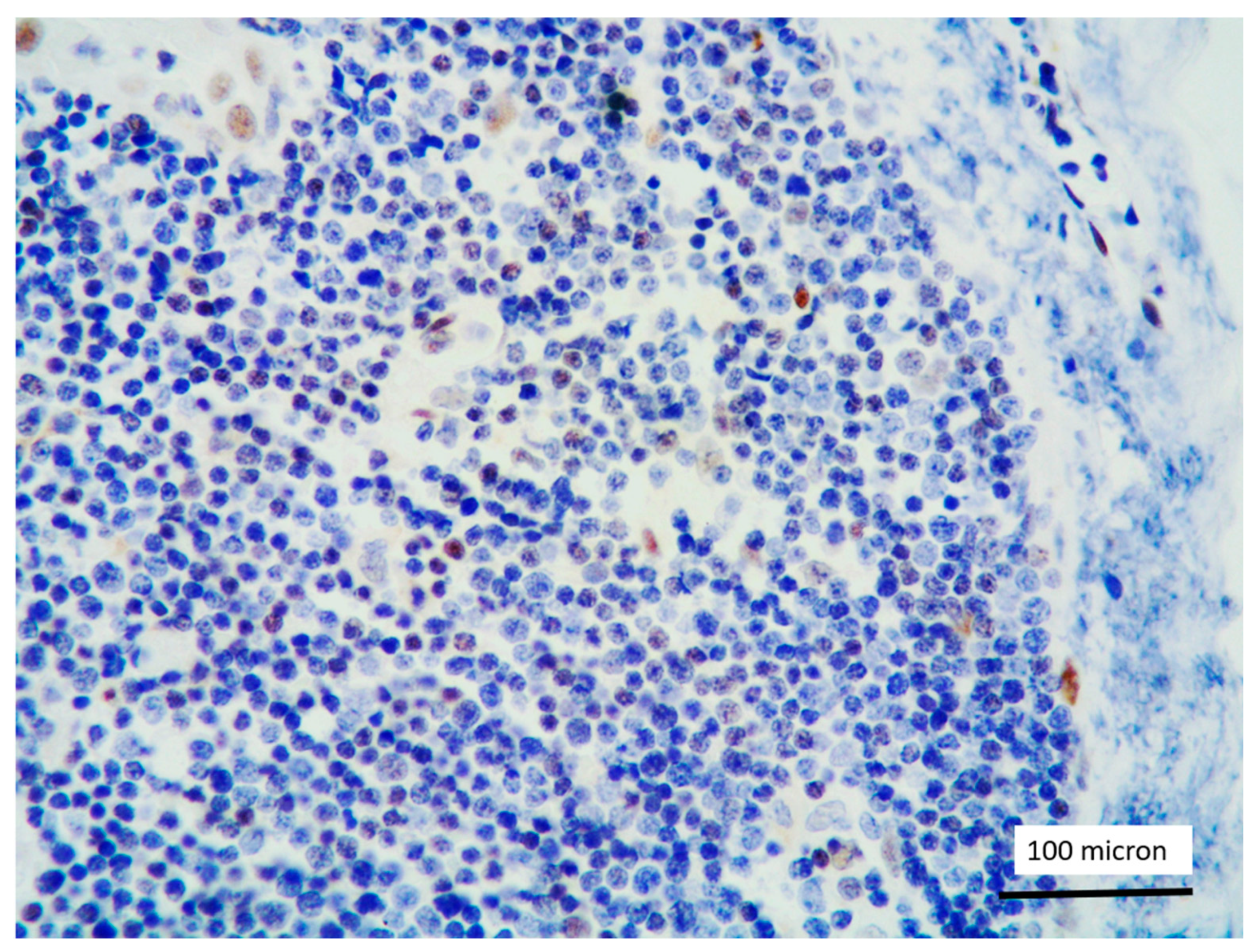 Cancers 13 03102 g009