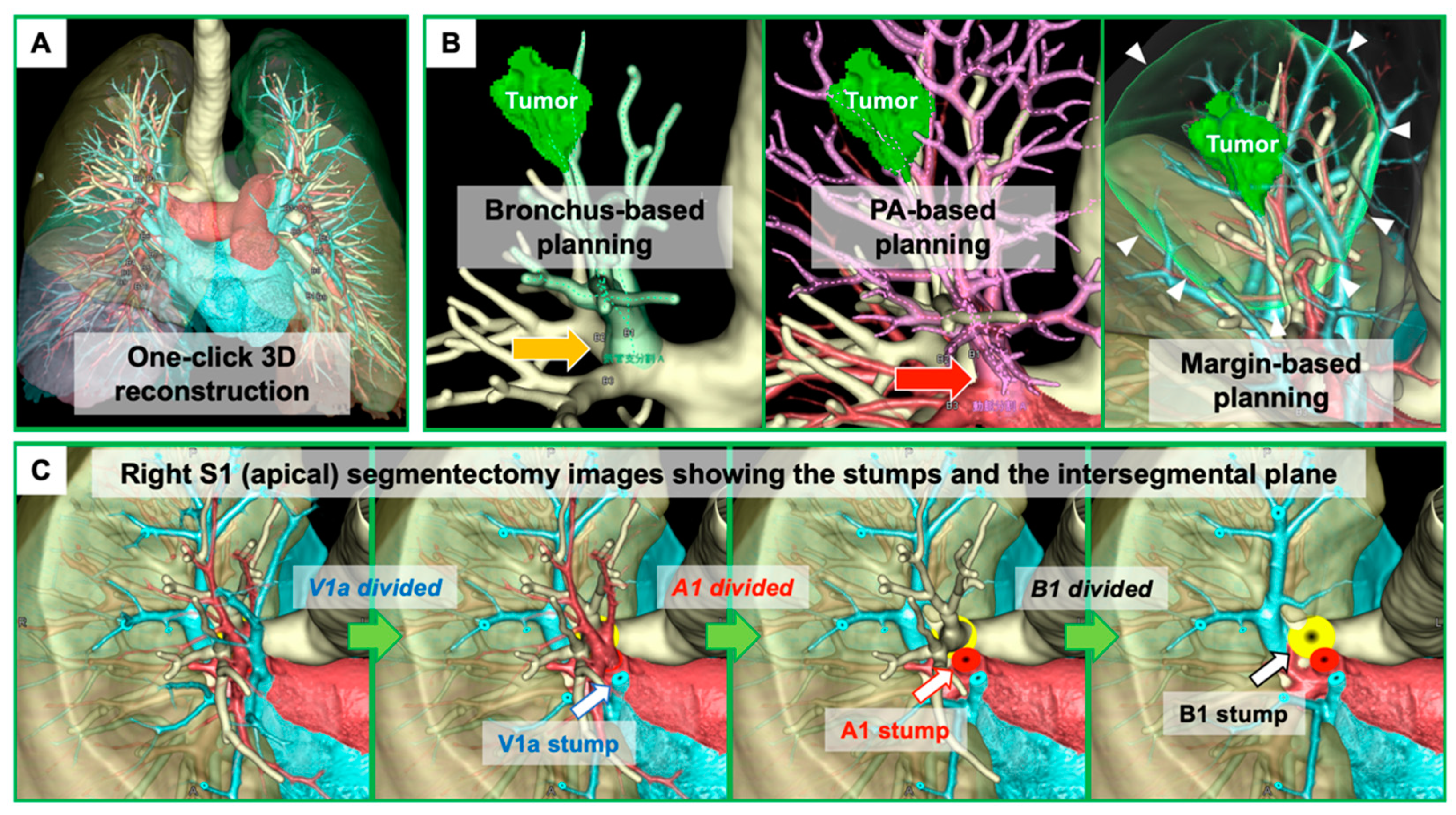 Cancers 13 03137 g001