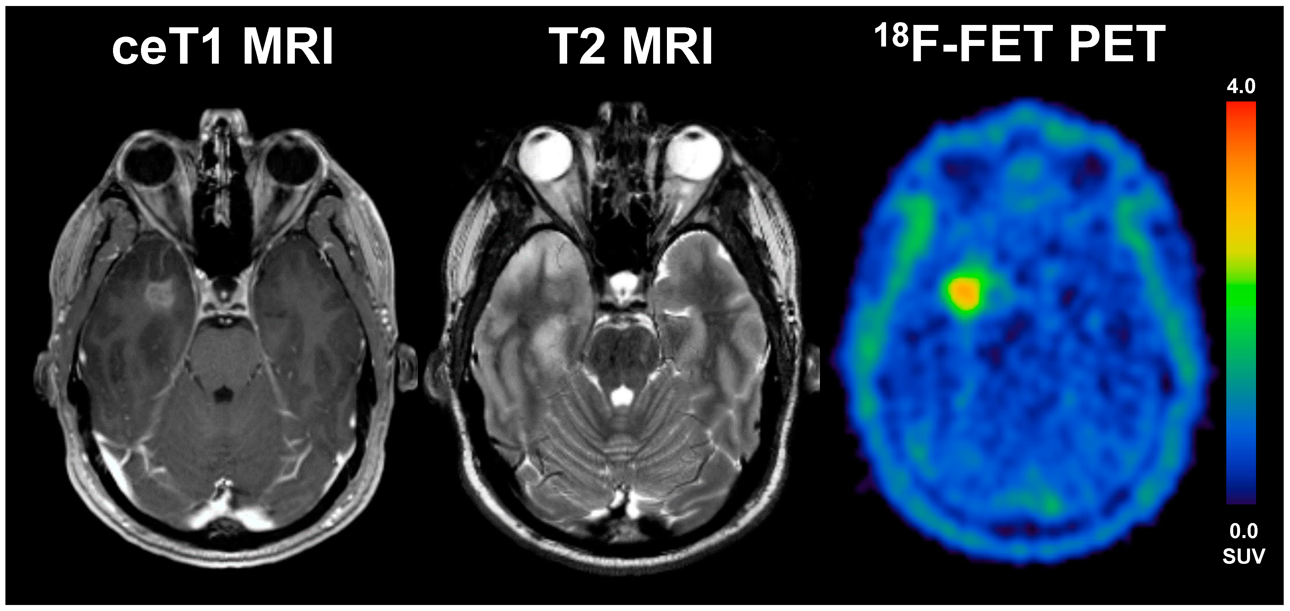 Cancers 13 03163 g003