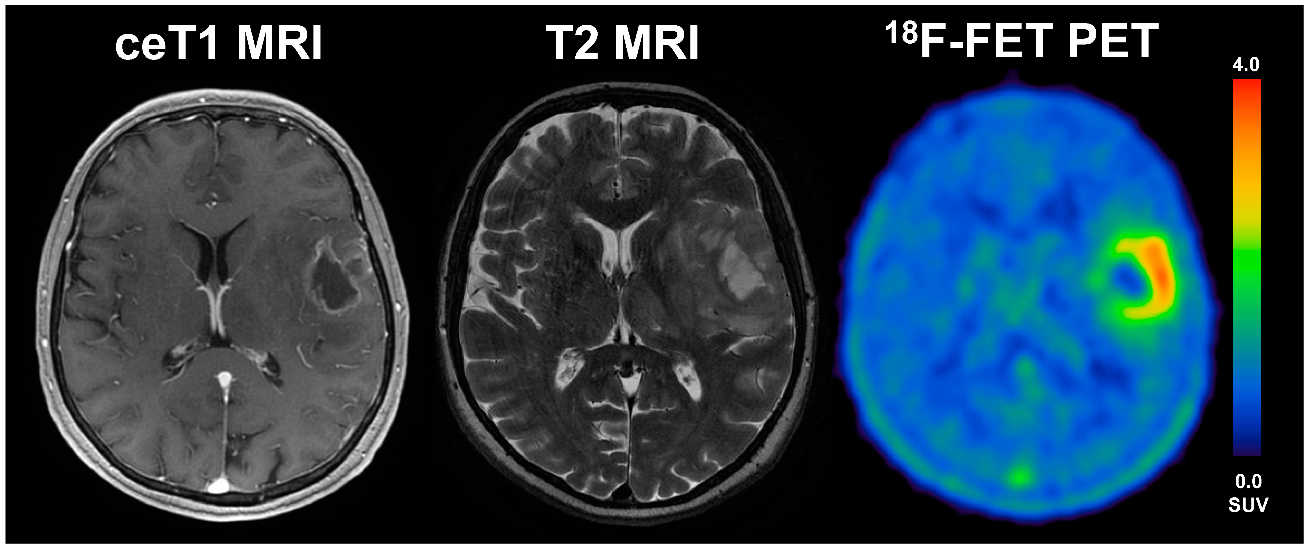Cancers 13 03163 g004