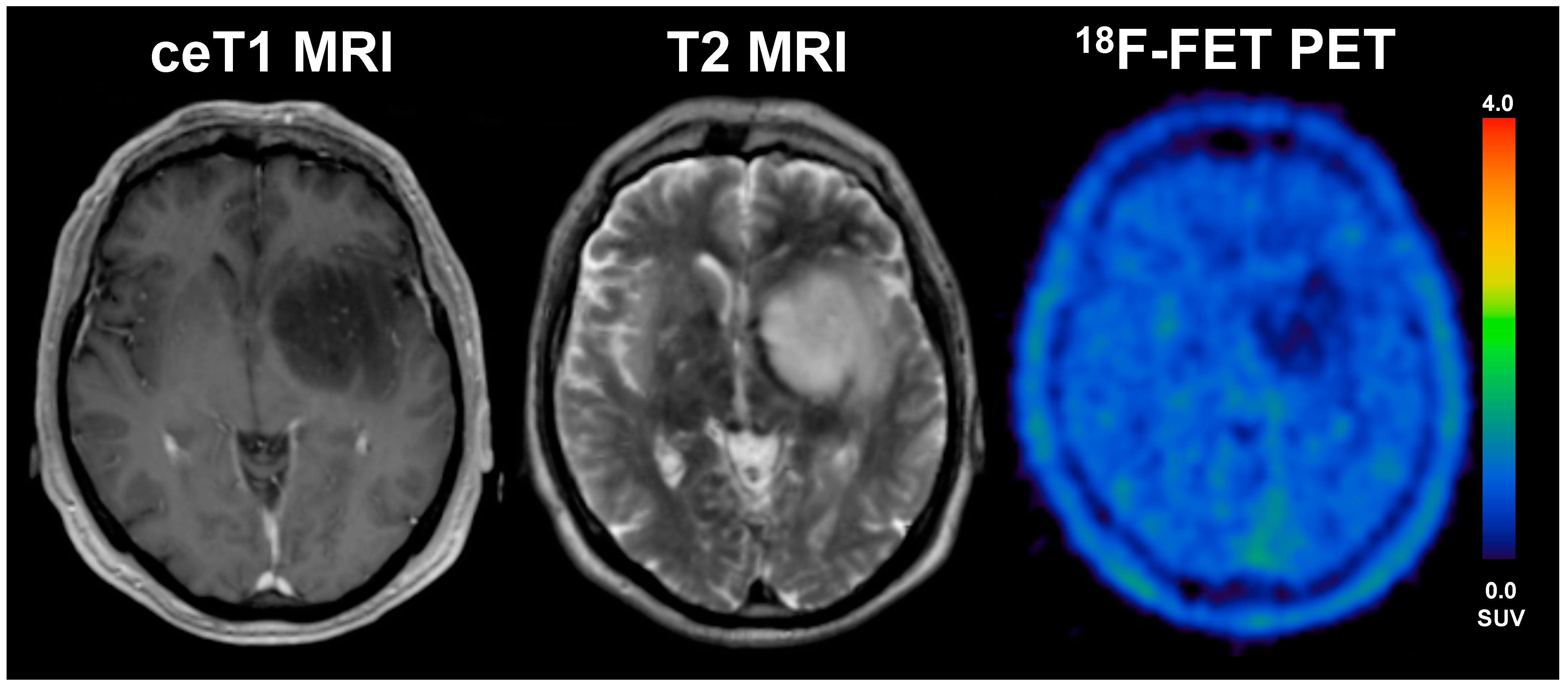 Cancers 13 03163 g005