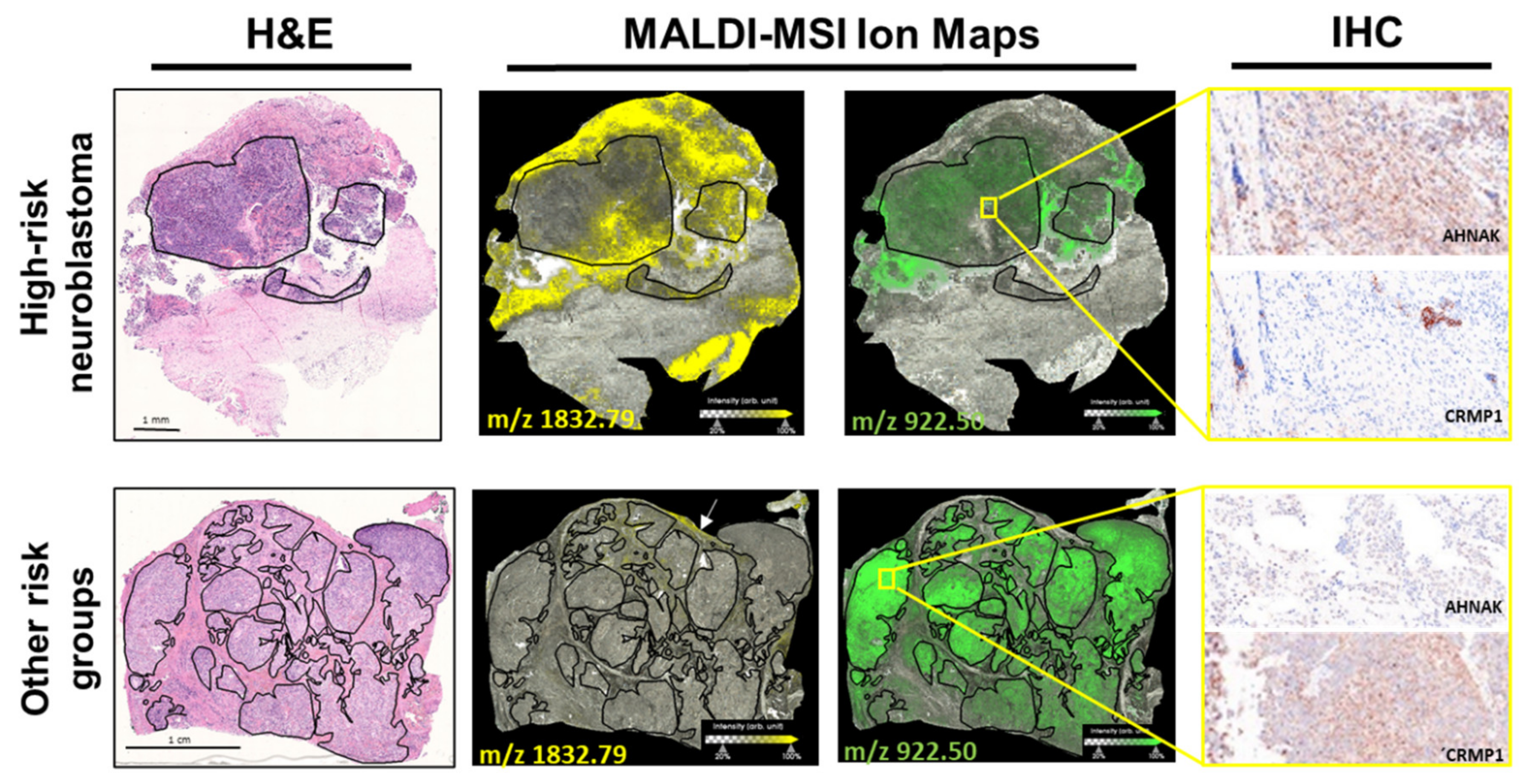 Cancers 13 03184 g003