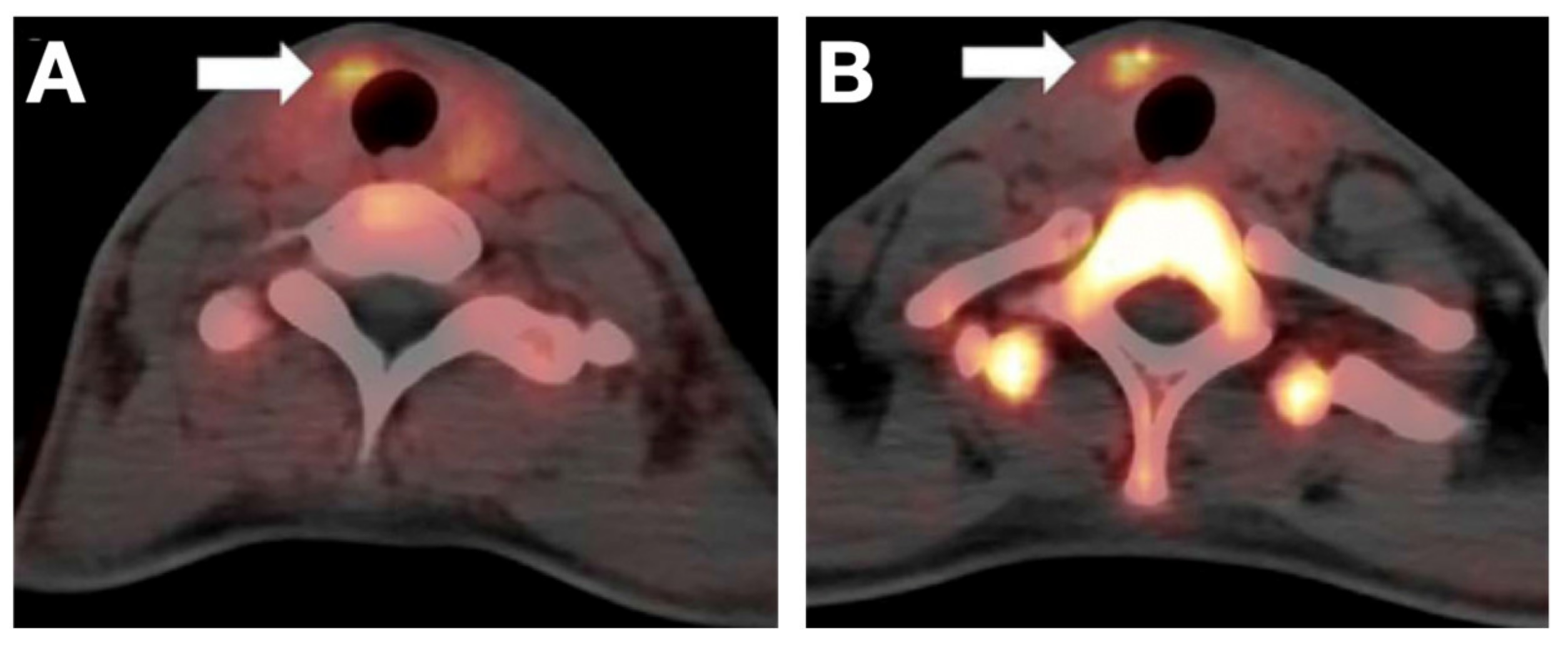 Cancers 13 03188 g004 Cancers 13 03188 g004